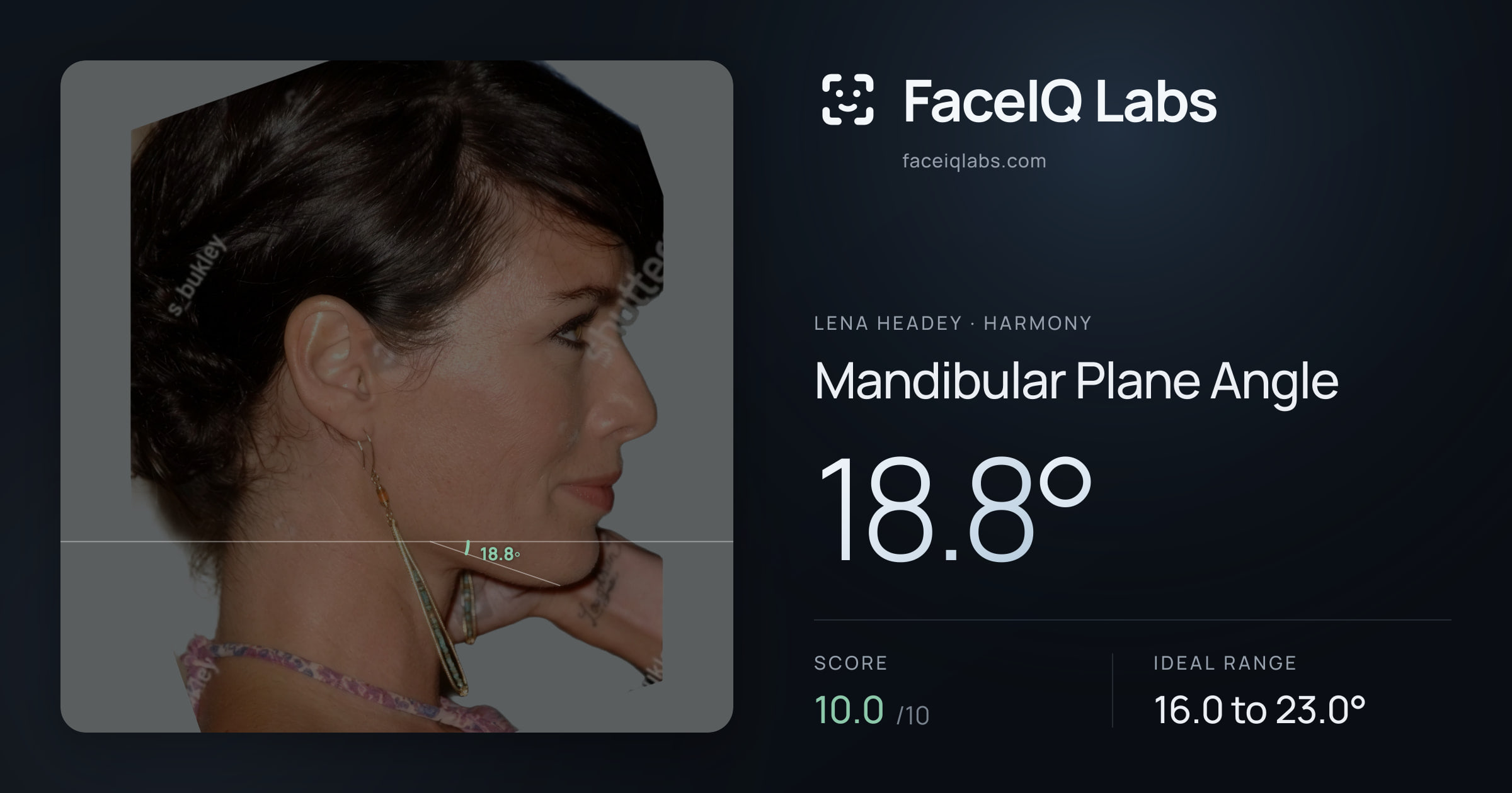 Lena Headey Mandibular Plane Angle: 18.8°, drawn on the photo