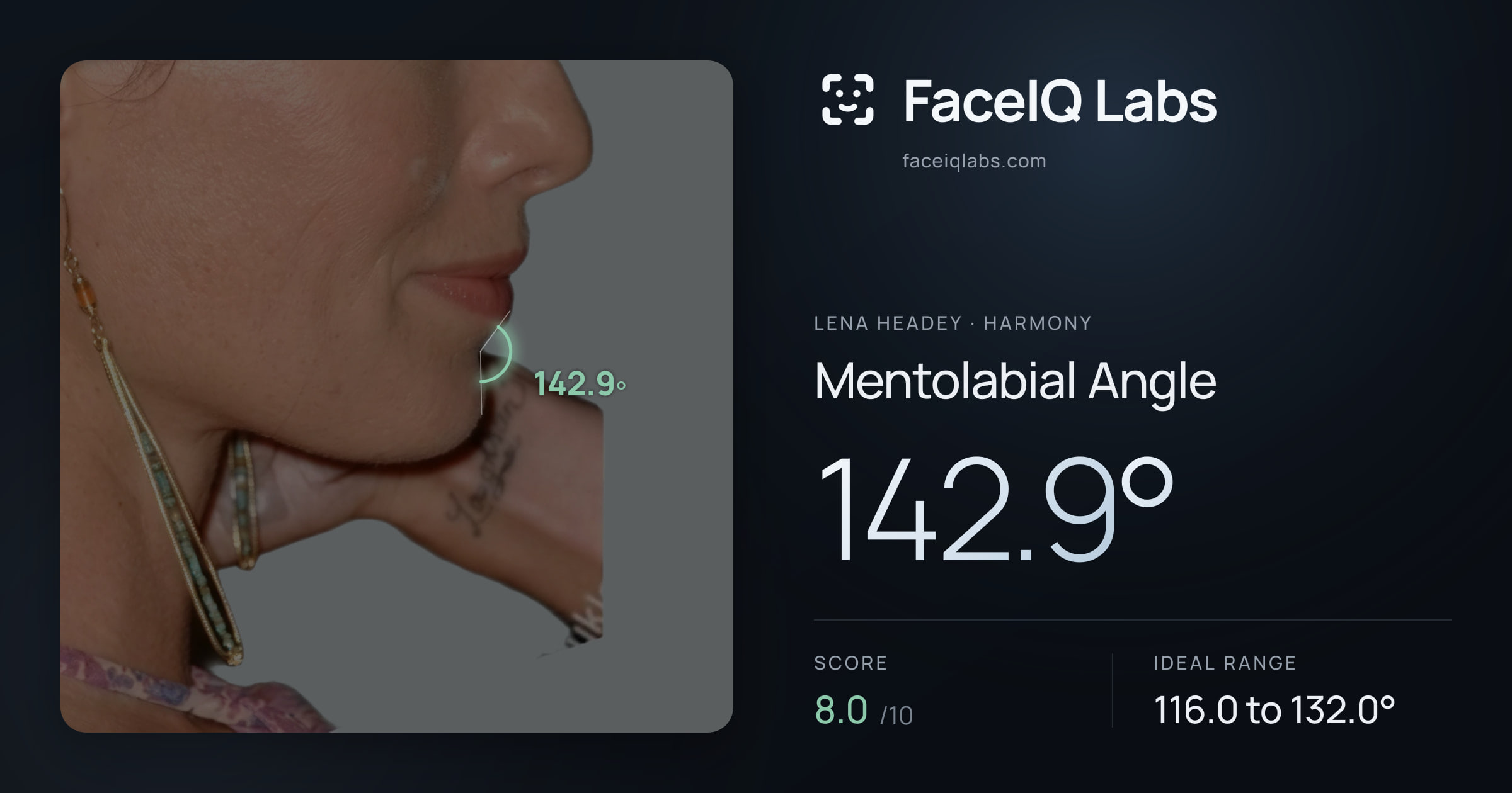 Lena Headey Mentolabial Angle: 142.9°, drawn on the photo