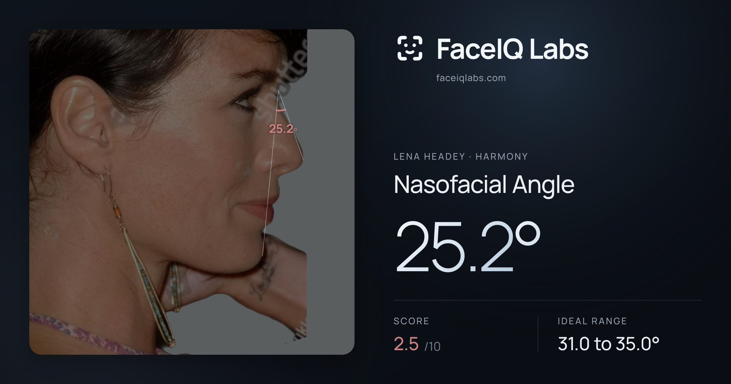 Lena Headey Nasofacial Angle: 25.2°, drawn on the photo