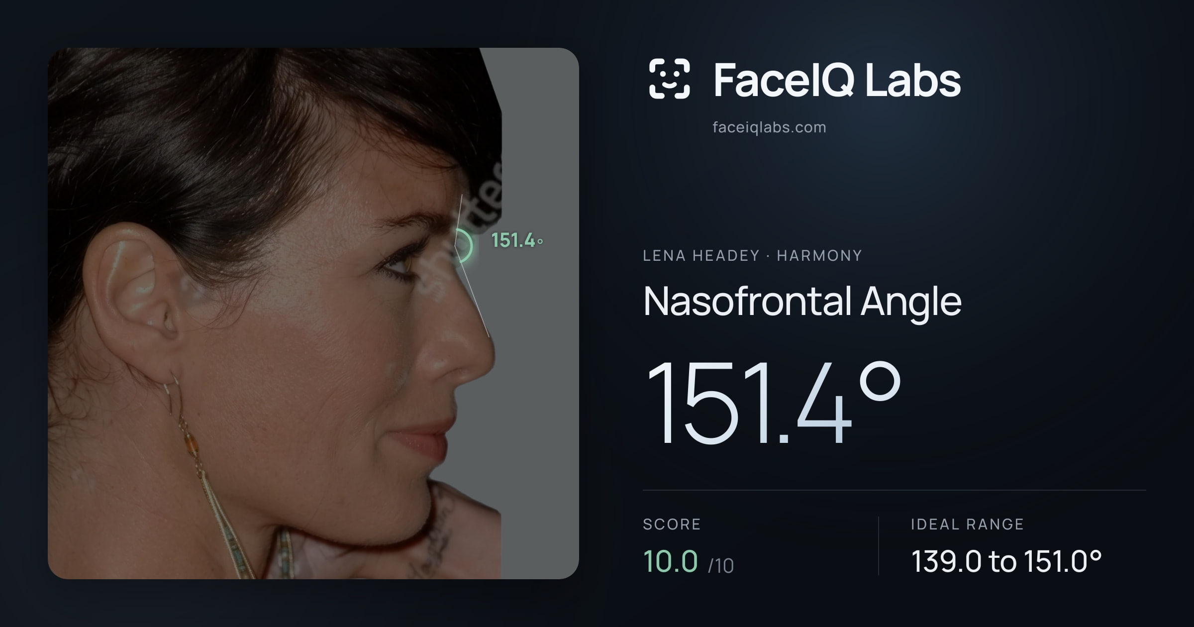 Lena Headey Nasofrontal Angle: 151.4°, drawn on the photo