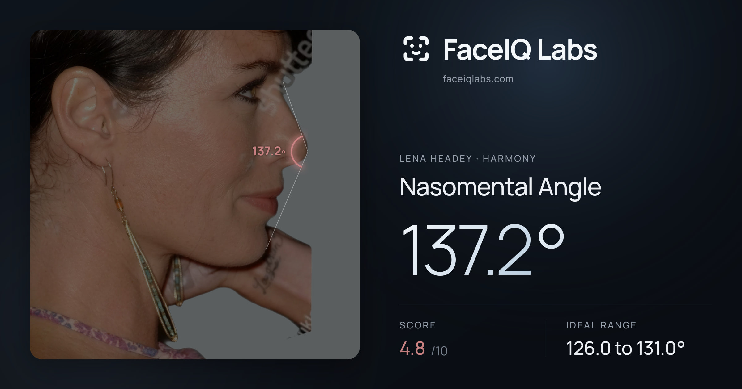 Lena Headey Nasomental Angle: 137.2°, drawn on the photo