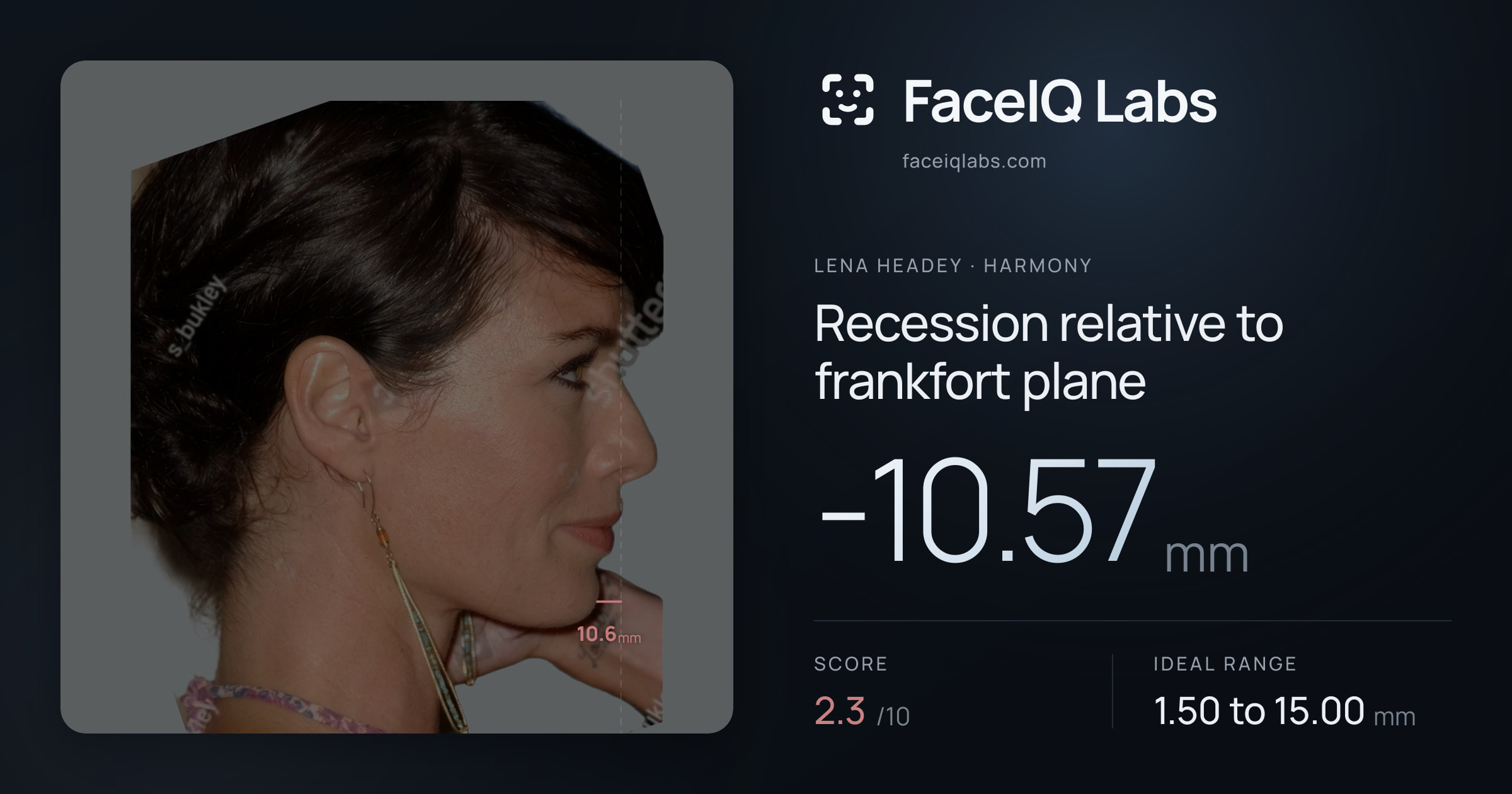 Lena Headey Recession relative to frankfort plane: -10.57mm, drawn on the photo