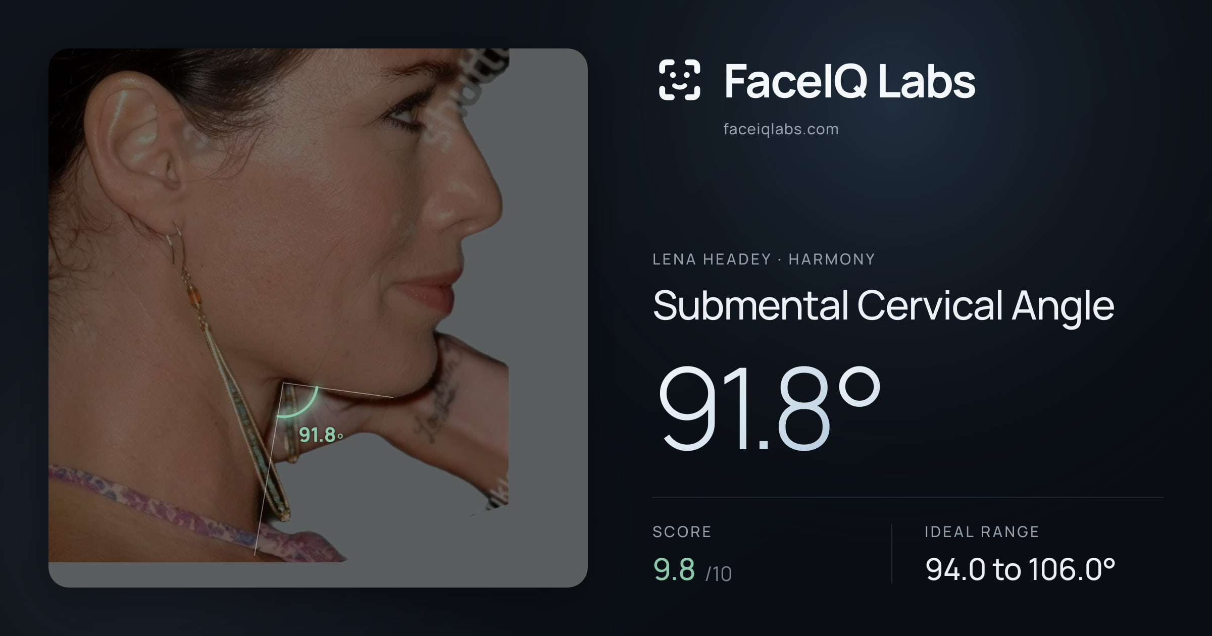 Lena Headey Submental Cervical Angle: 91.8°, drawn on the photo