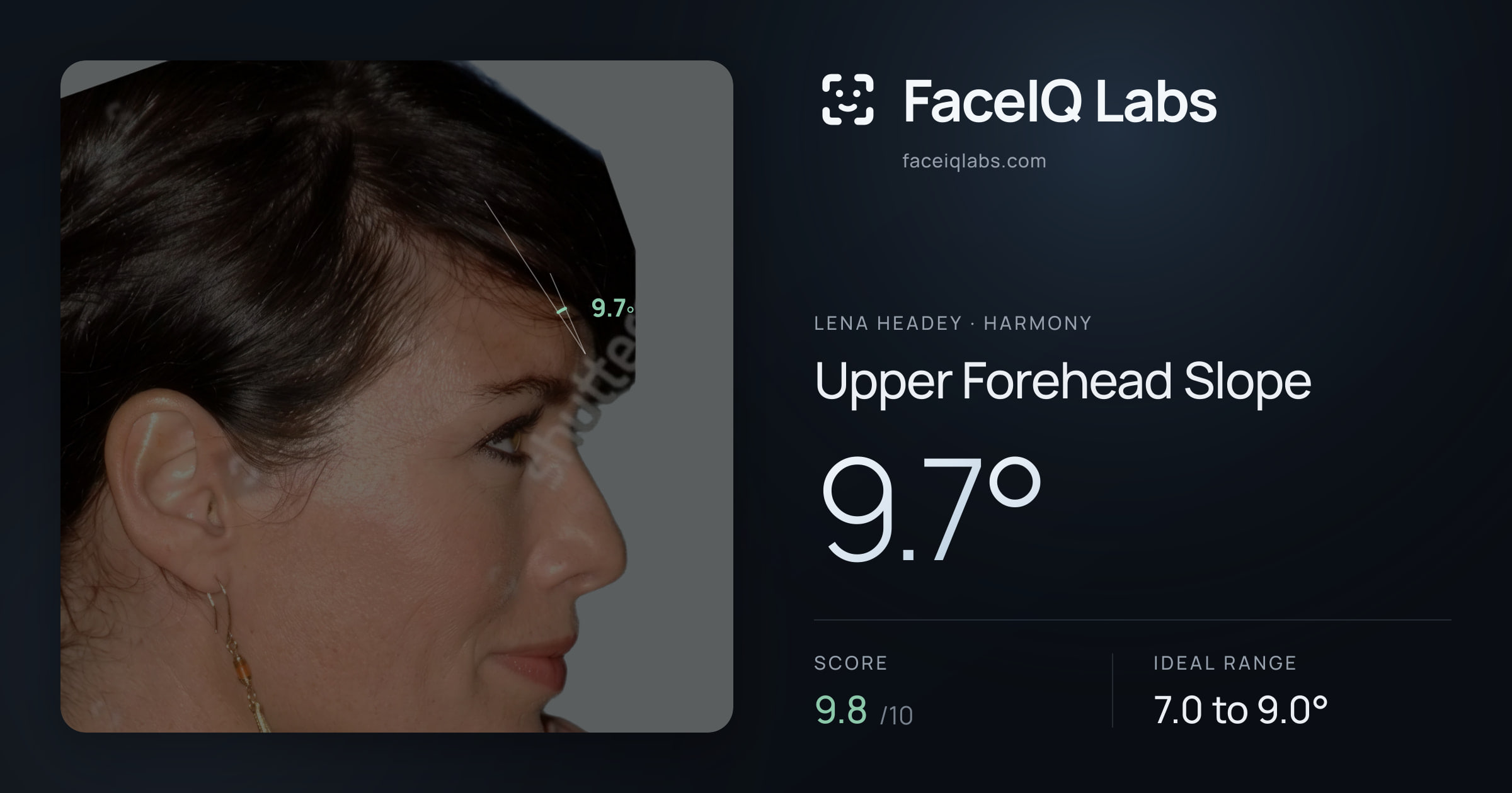 Lena Headey Upper Forehead Slope: 9.7°, drawn on the photo