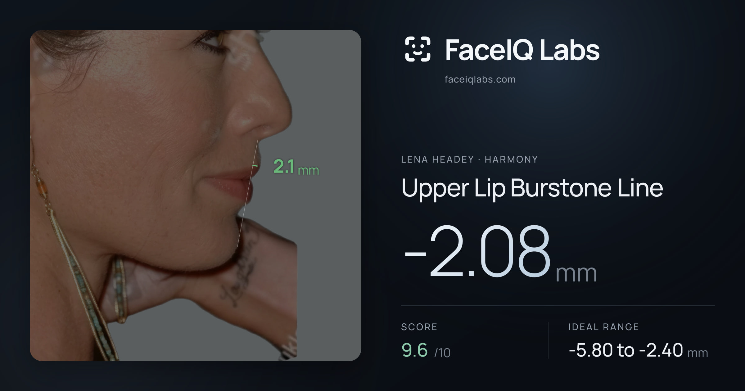 Lena Headey Upper Lip Burstone Line: -2.08mm, drawn on the photo