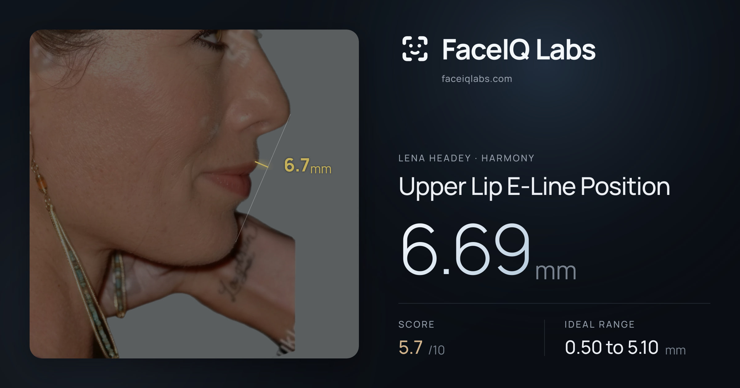 Lena Headey Upper Lip E-Line Position: 6.69mm, drawn on the photo