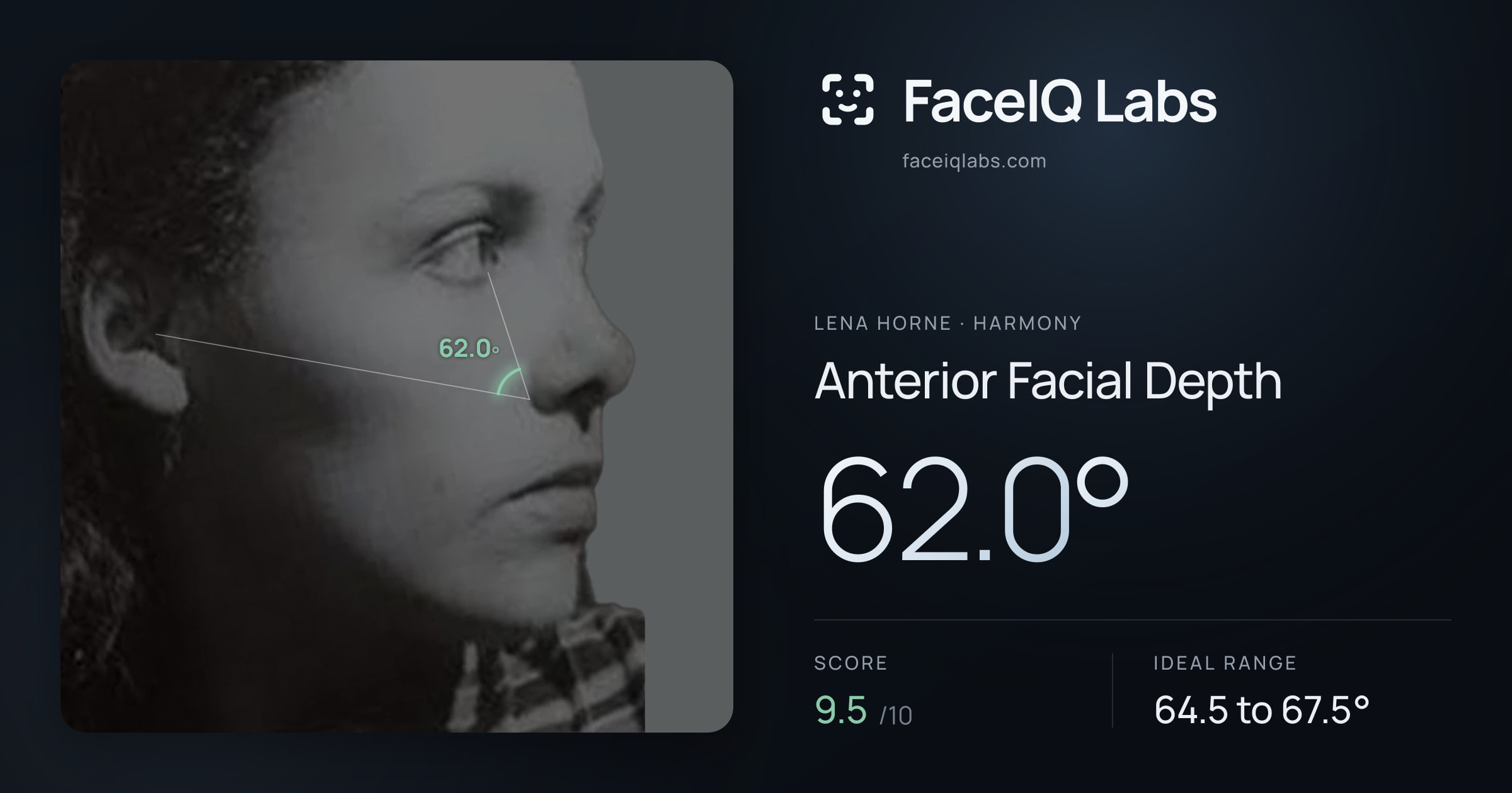 Lena Horne Anterior Facial Depth: 62.0°, drawn on the photo