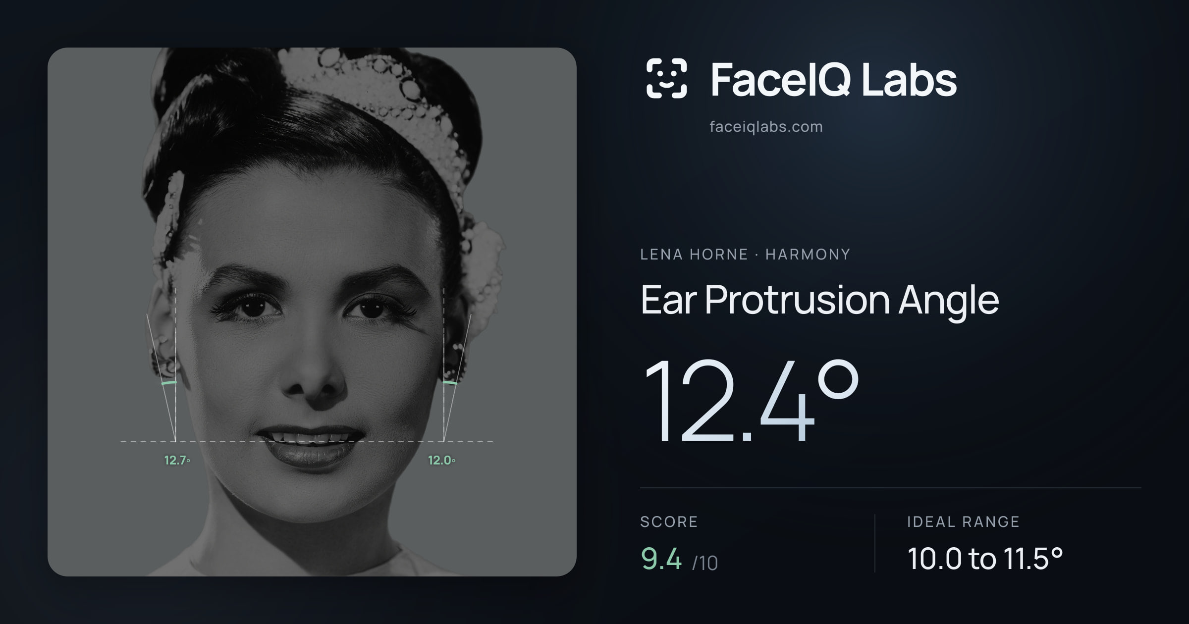 Lena Horne Ear Protrusion Angle: 12.4°, drawn on the photo