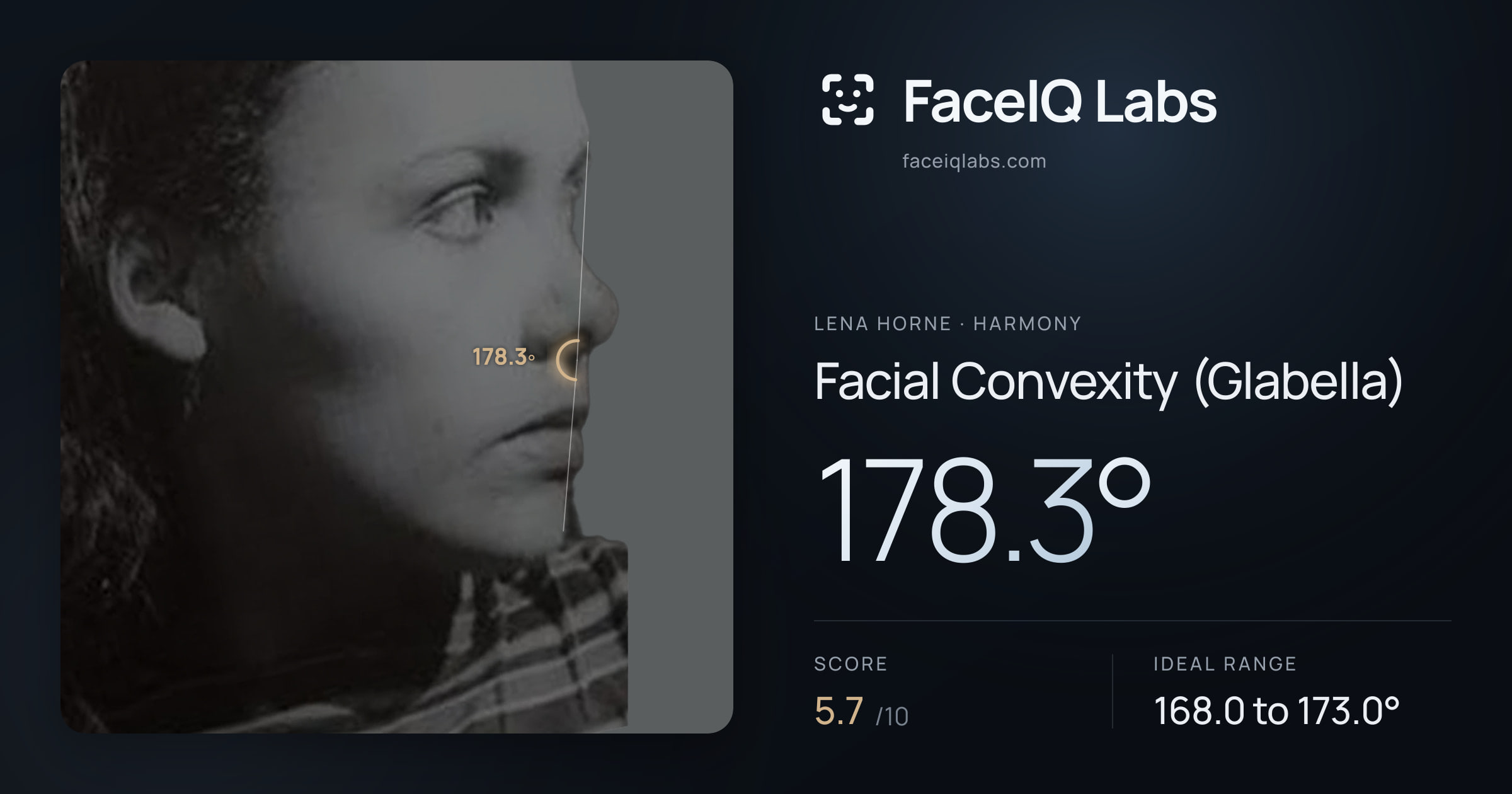 Lena Horne Facial Convexity (Glabella): 178.3°, drawn on the photo