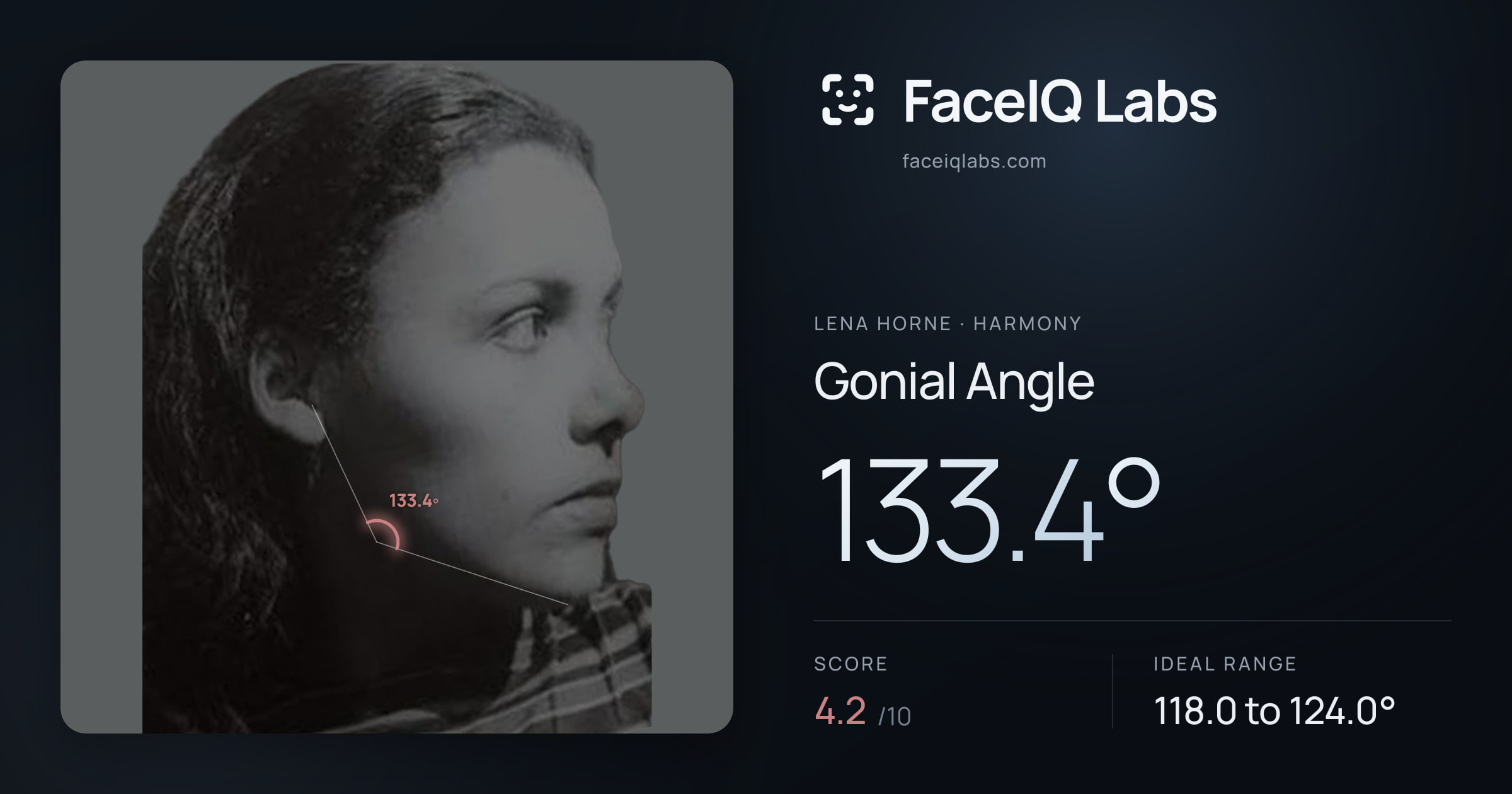 Lena Horne Gonial Angle: 133.4°, drawn on the photo