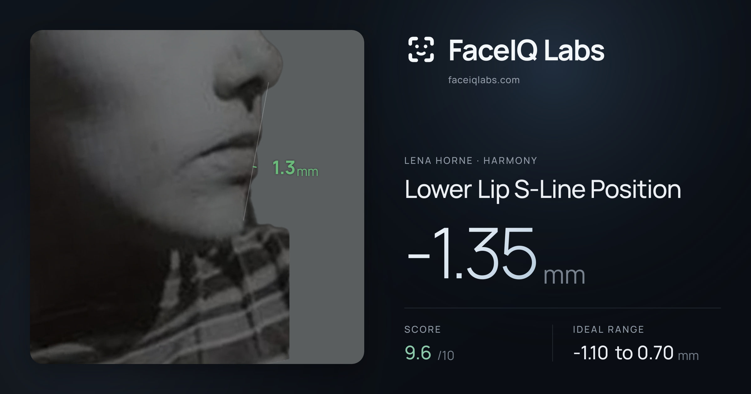 Lena Horne Lower Lip S-Line Position: -1.35mm, drawn on the photo