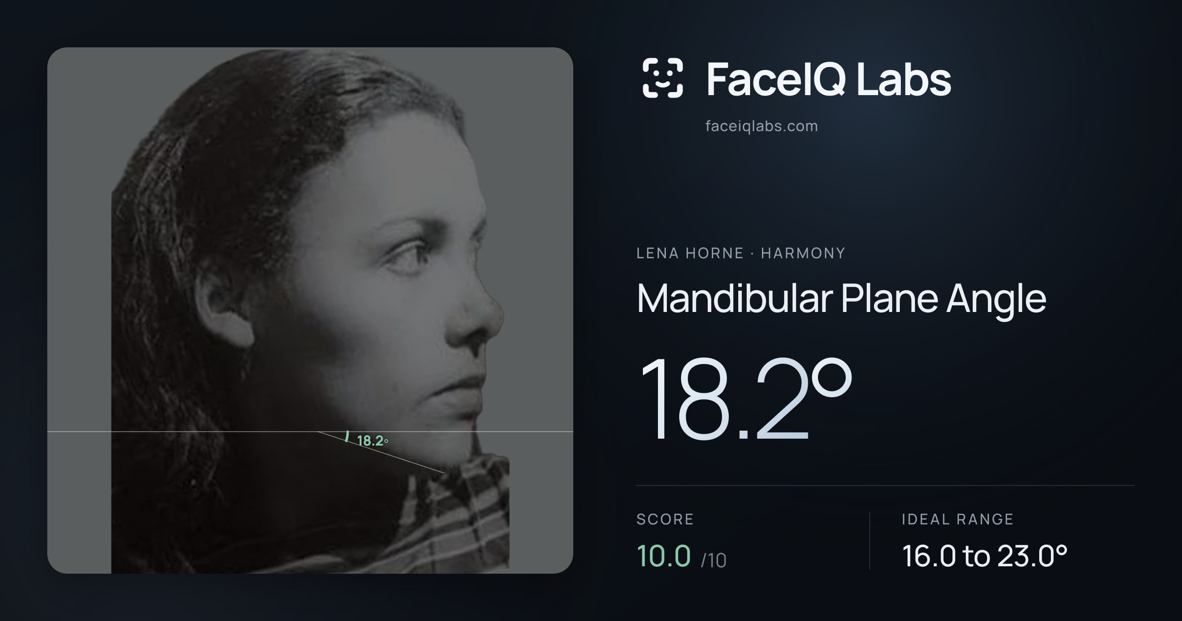 Lena Horne Mandibular Plane Angle: 18.2°, drawn on the photo