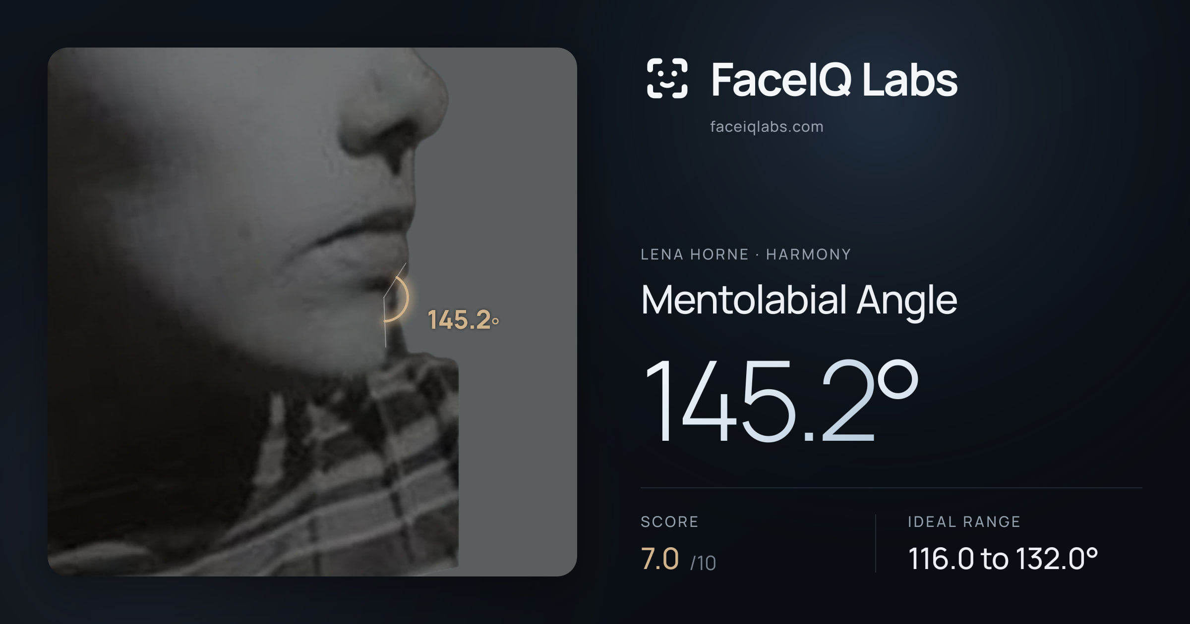 Lena Horne Mentolabial Angle: 145.2°, drawn on the photo