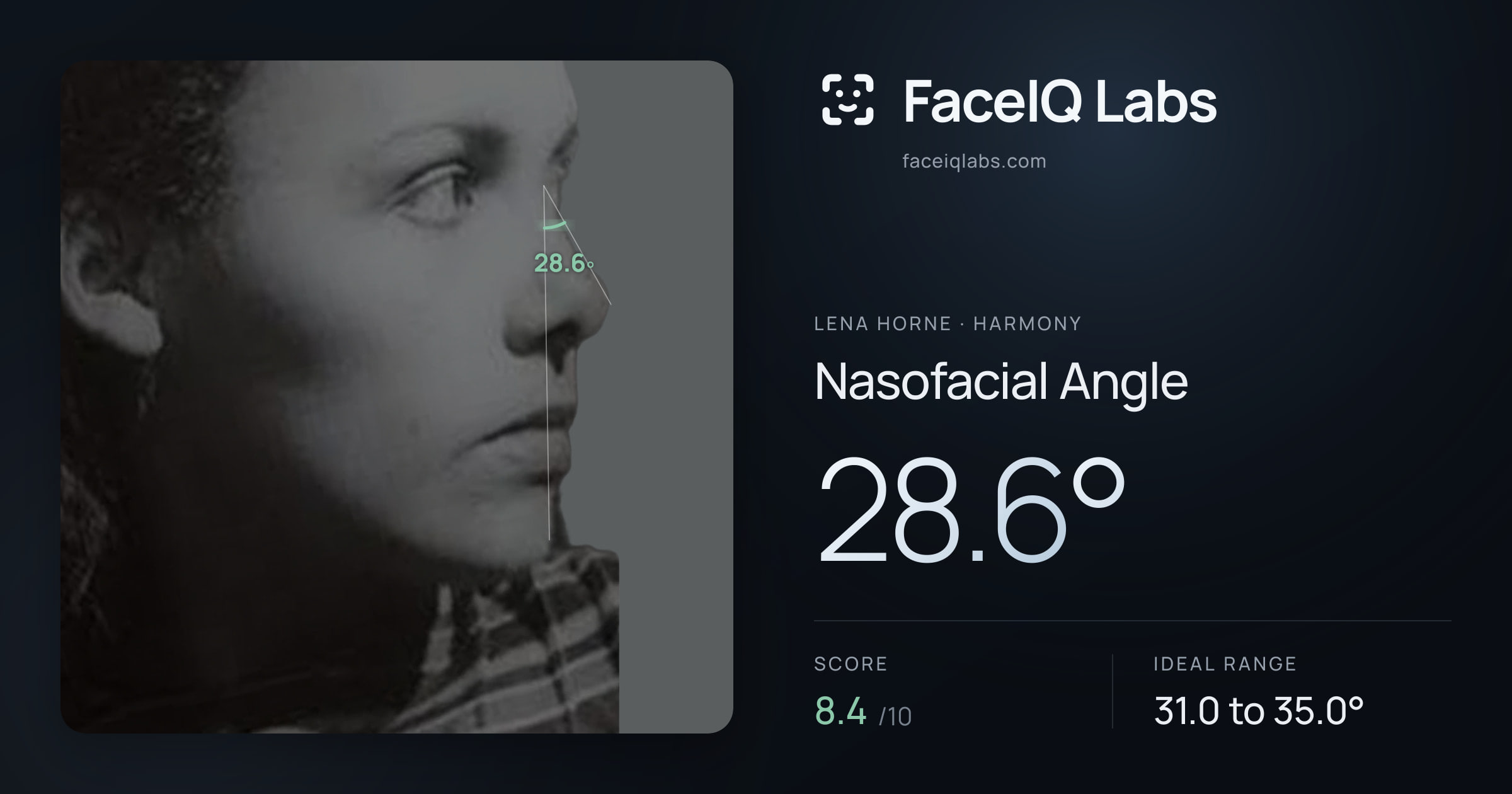 Lena Horne Nasofacial Angle: 28.6°, drawn on the photo