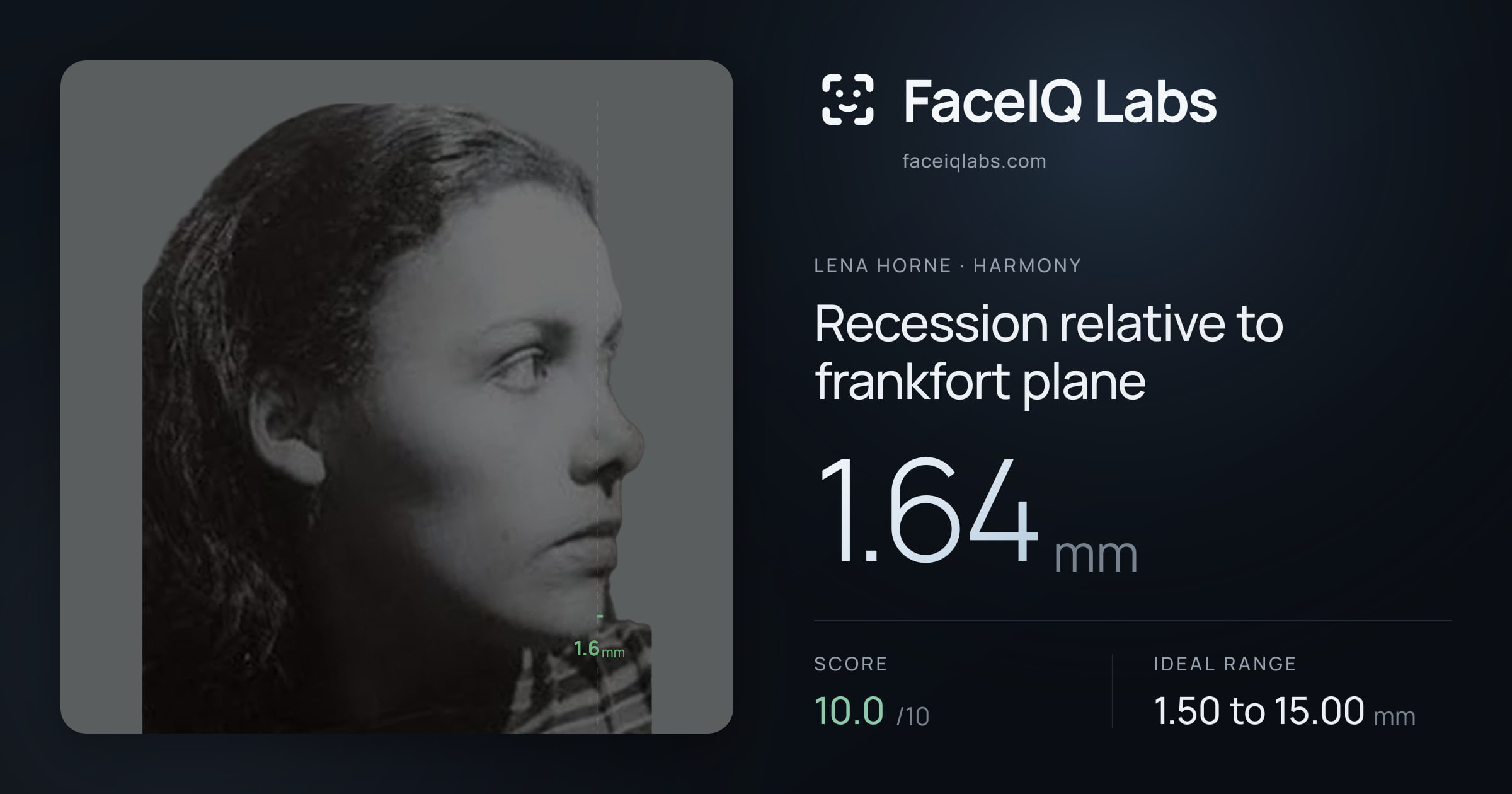 Lena Horne Recession relative to frankfort plane: 1.64mm, drawn on the photo