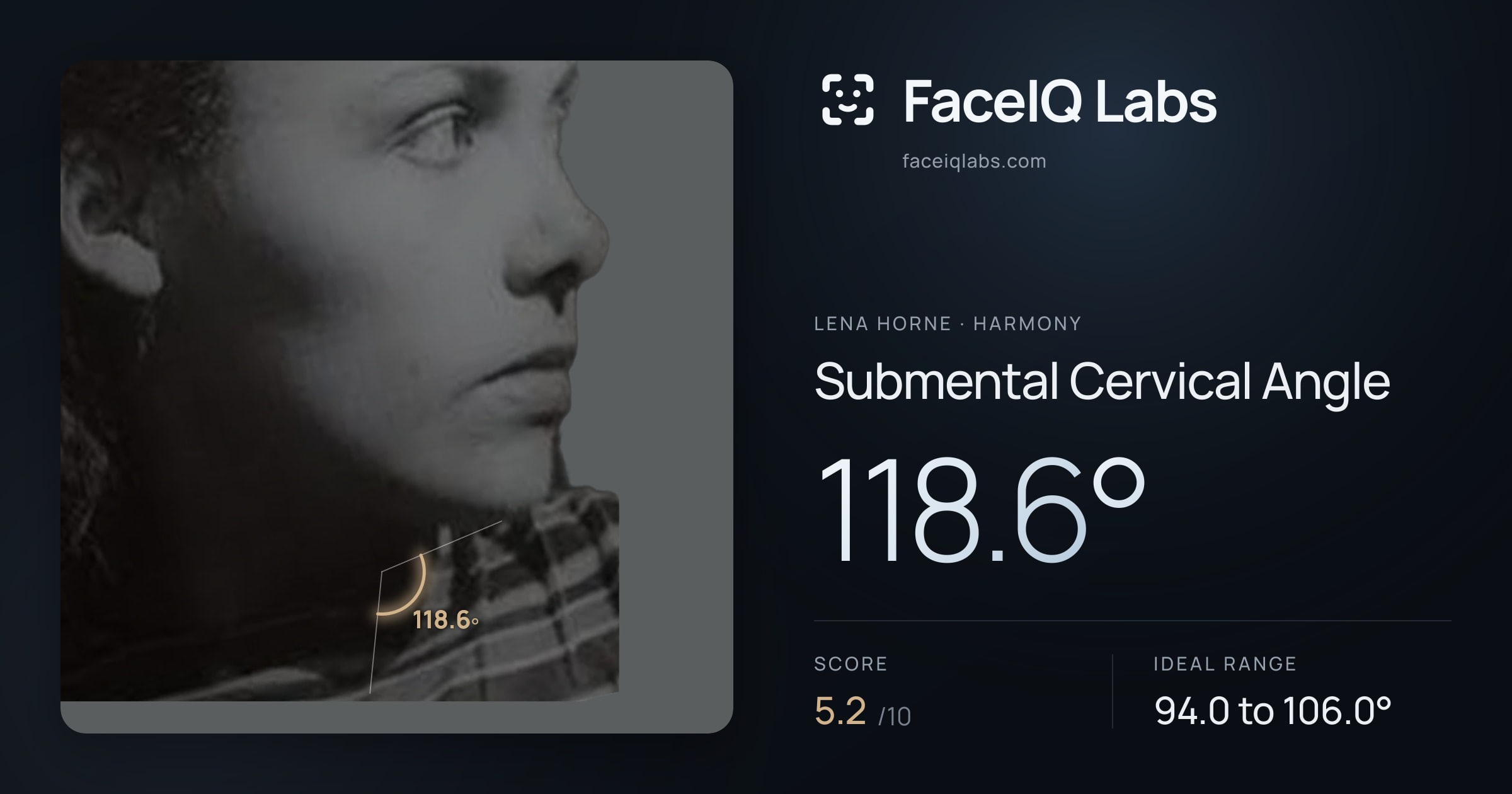Lena Horne Submental Cervical Angle: 118.6°, drawn on the photo