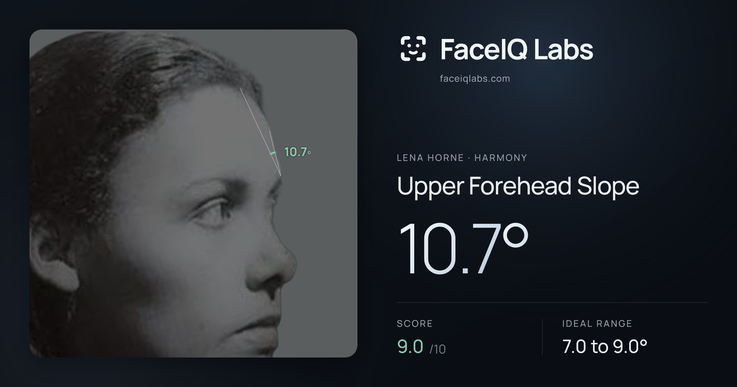 Lena Horne Upper Forehead Slope: 10.7°, drawn on the photo