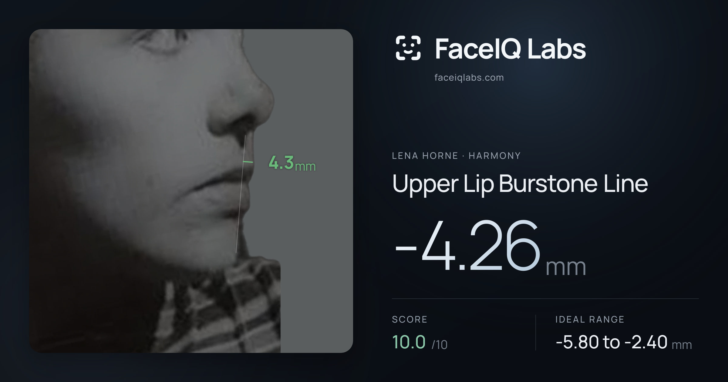 Lena Horne Upper Lip Burstone Line: -4.26mm, drawn on the photo