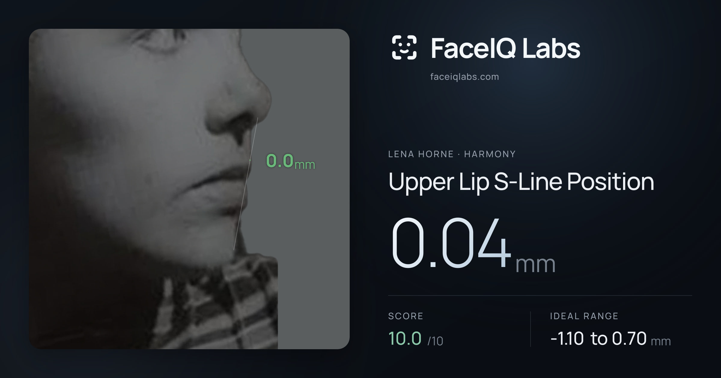 Lena Horne Upper Lip S-Line Position: 0.04mm, drawn on the photo