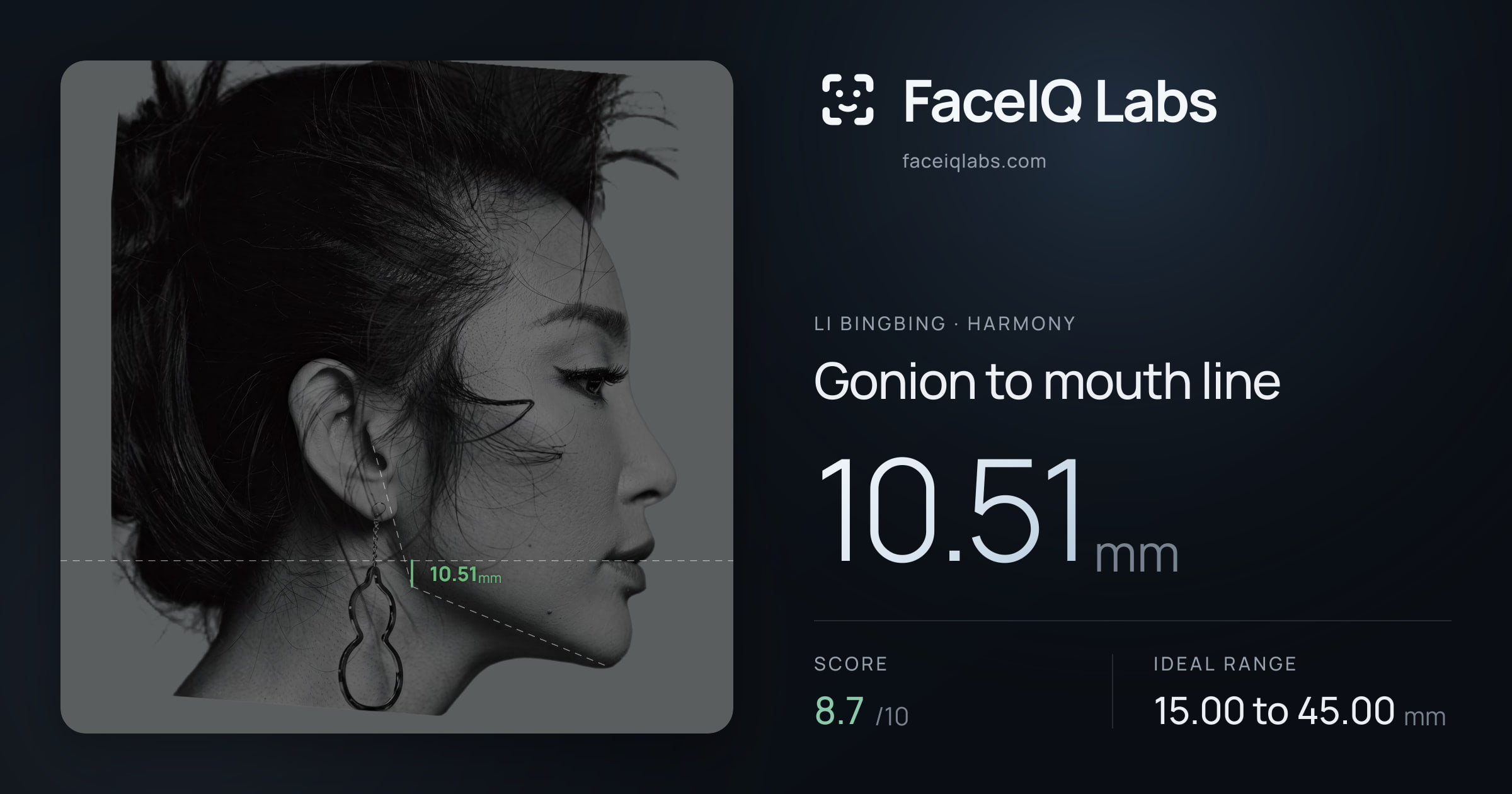 Li Bingbing Gonion to mouth line: 10.51mm, drawn on the photo