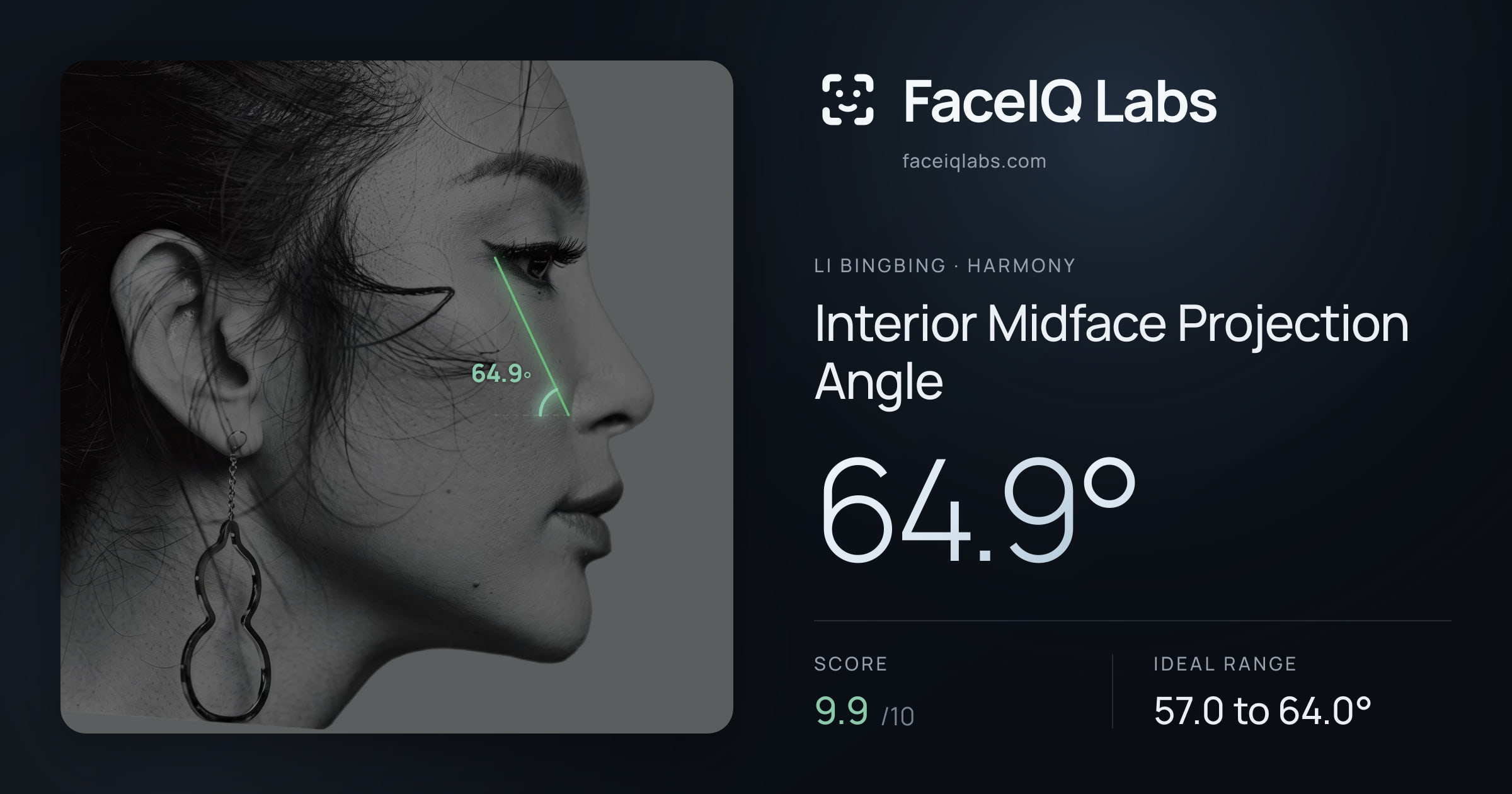 Li Bingbing Interior Midface Projection Angle: 64.9°, drawn on the photo