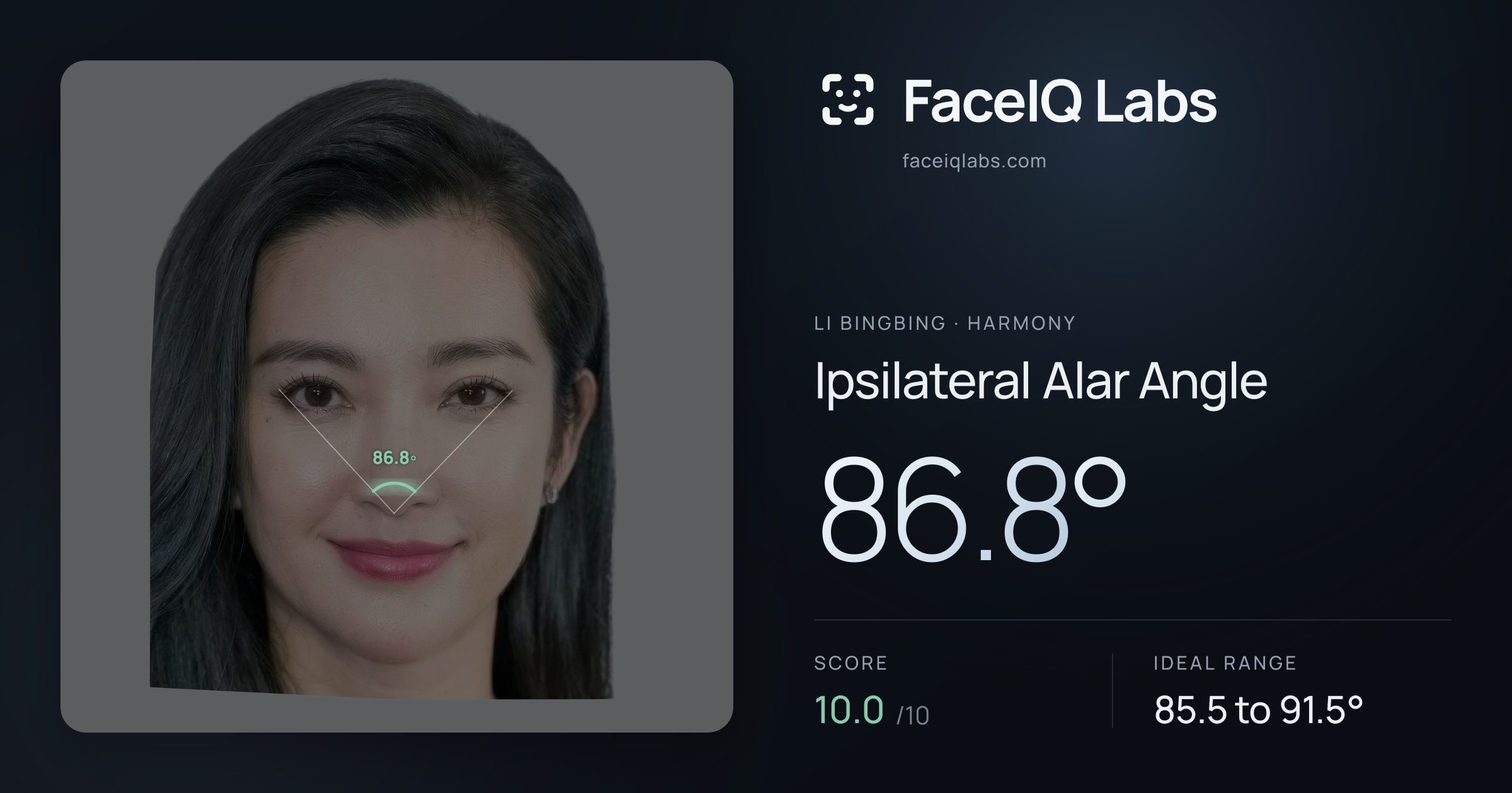 Li Bingbing Ipsilateral Alar Angle: 86.8°, drawn on the photo