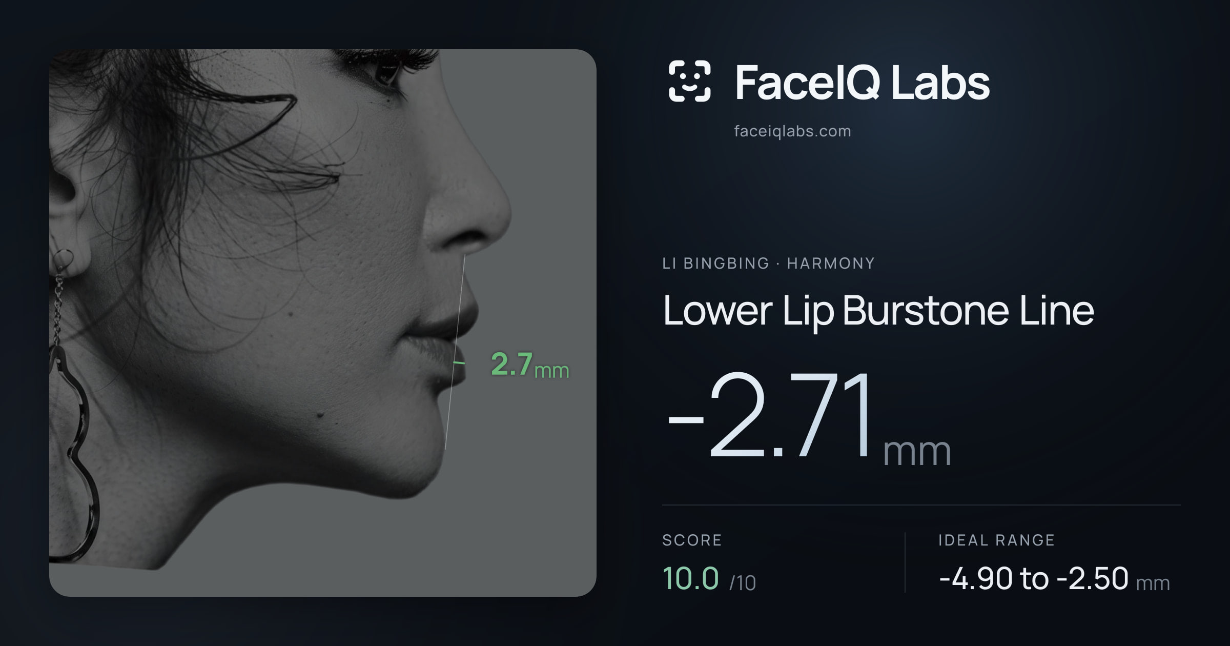 Li Bingbing Lower Lip Burstone Line: -2.71mm, drawn on the photo