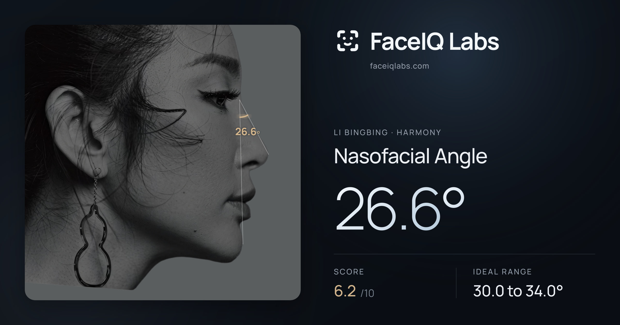 Li Bingbing Nasofacial Angle: 26.6°, drawn on the photo