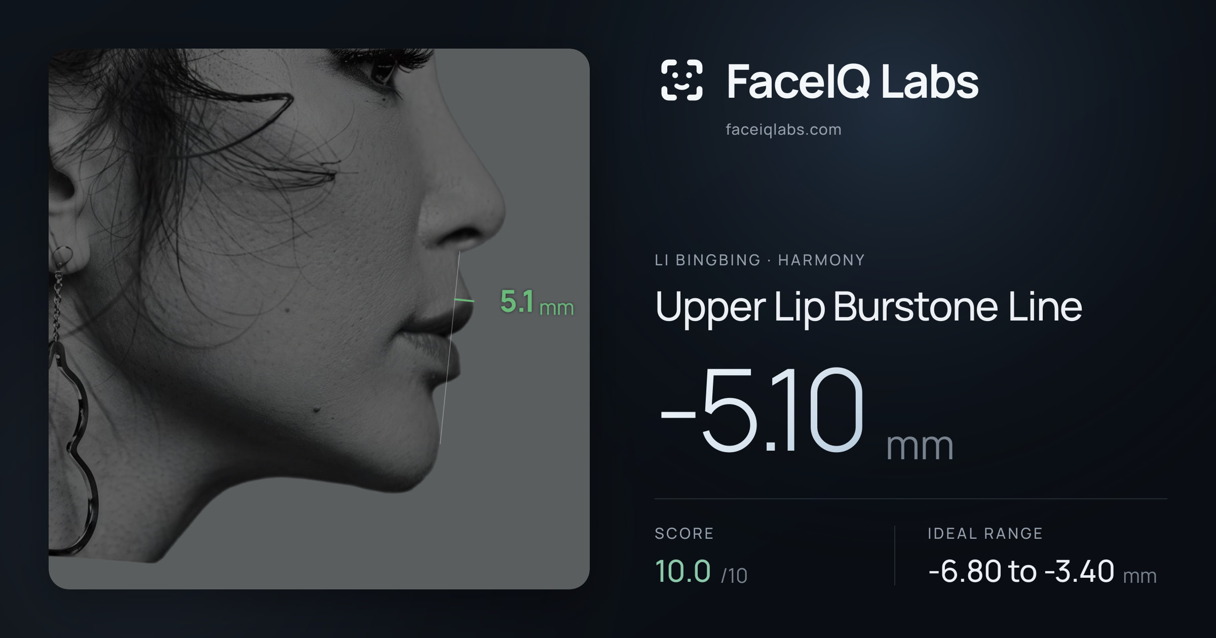Li Bingbing Upper Lip Burstone Line: -5.10mm, drawn on the photo