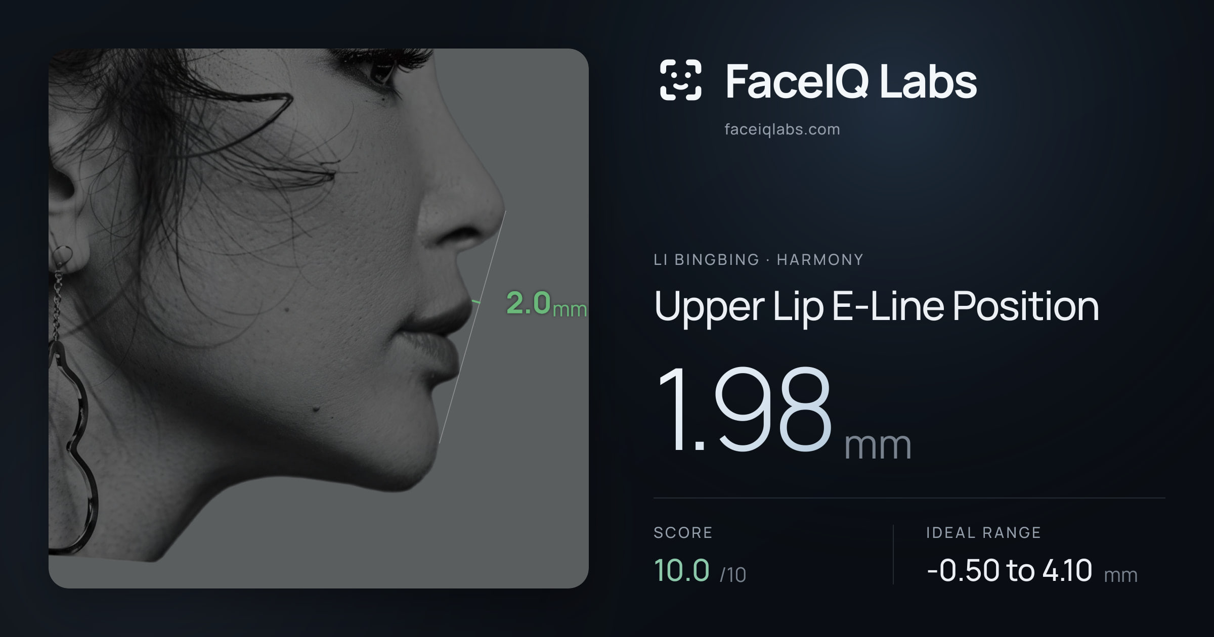 Li Bingbing Upper Lip E-Line Position: 1.98mm, drawn on the photo