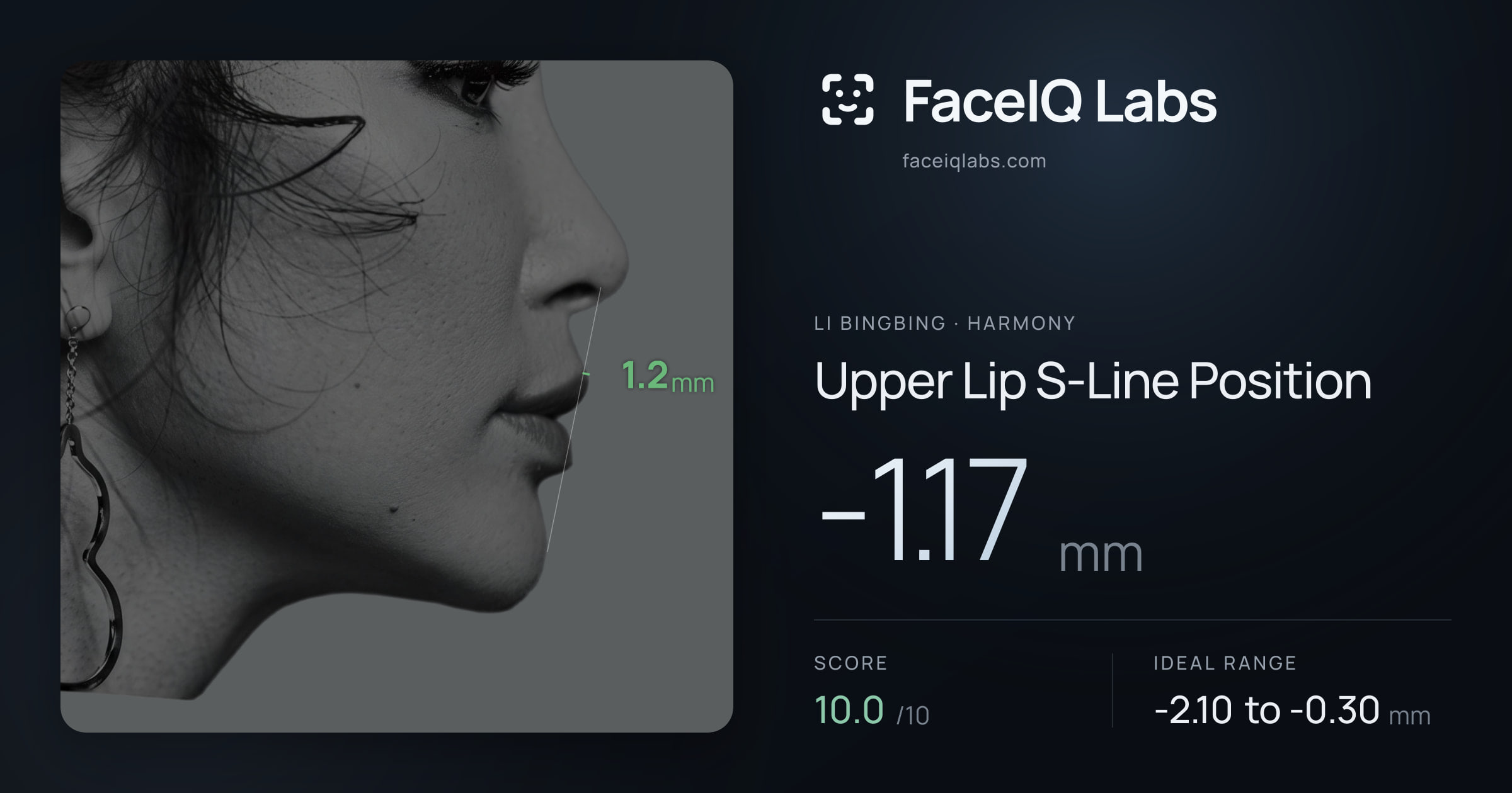 Li Bingbing Upper Lip S-Line Position: -1.17mm, drawn on the photo