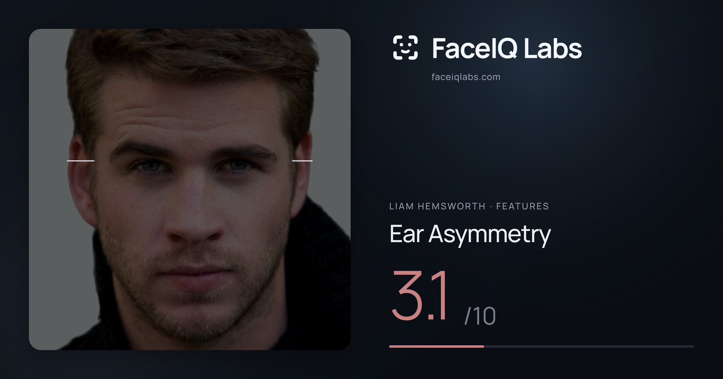 Liam Hemsworth Ear Asymmetry: 3.1/10, drawn on the photo