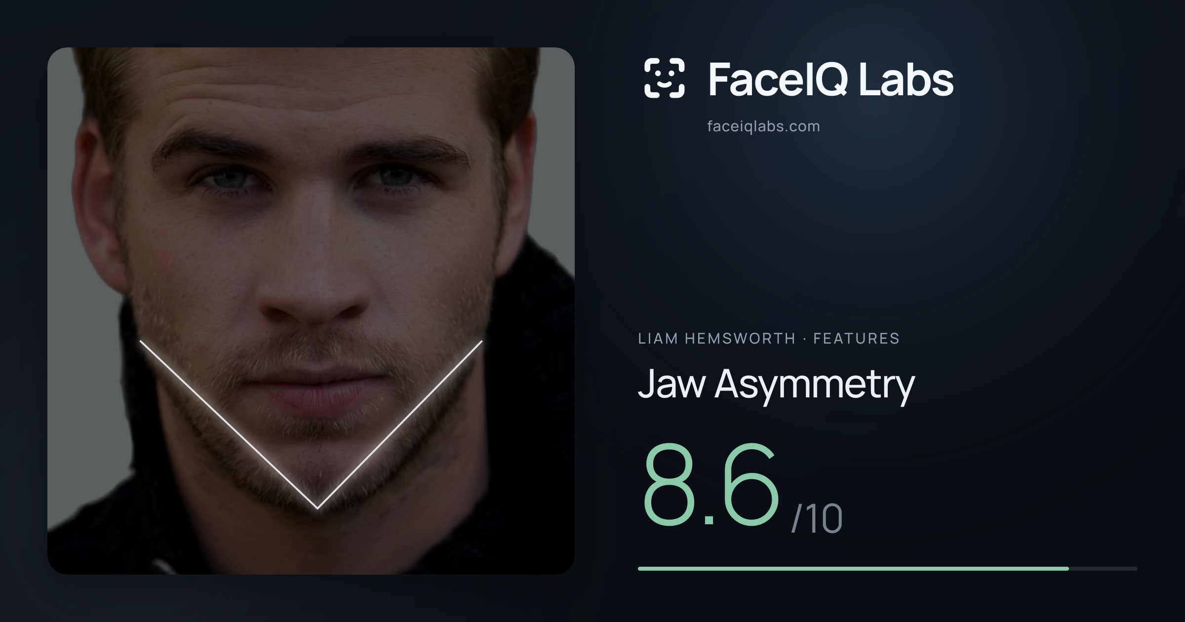Liam Hemsworth Jaw Asymmetry: 8.6/10, drawn on the photo