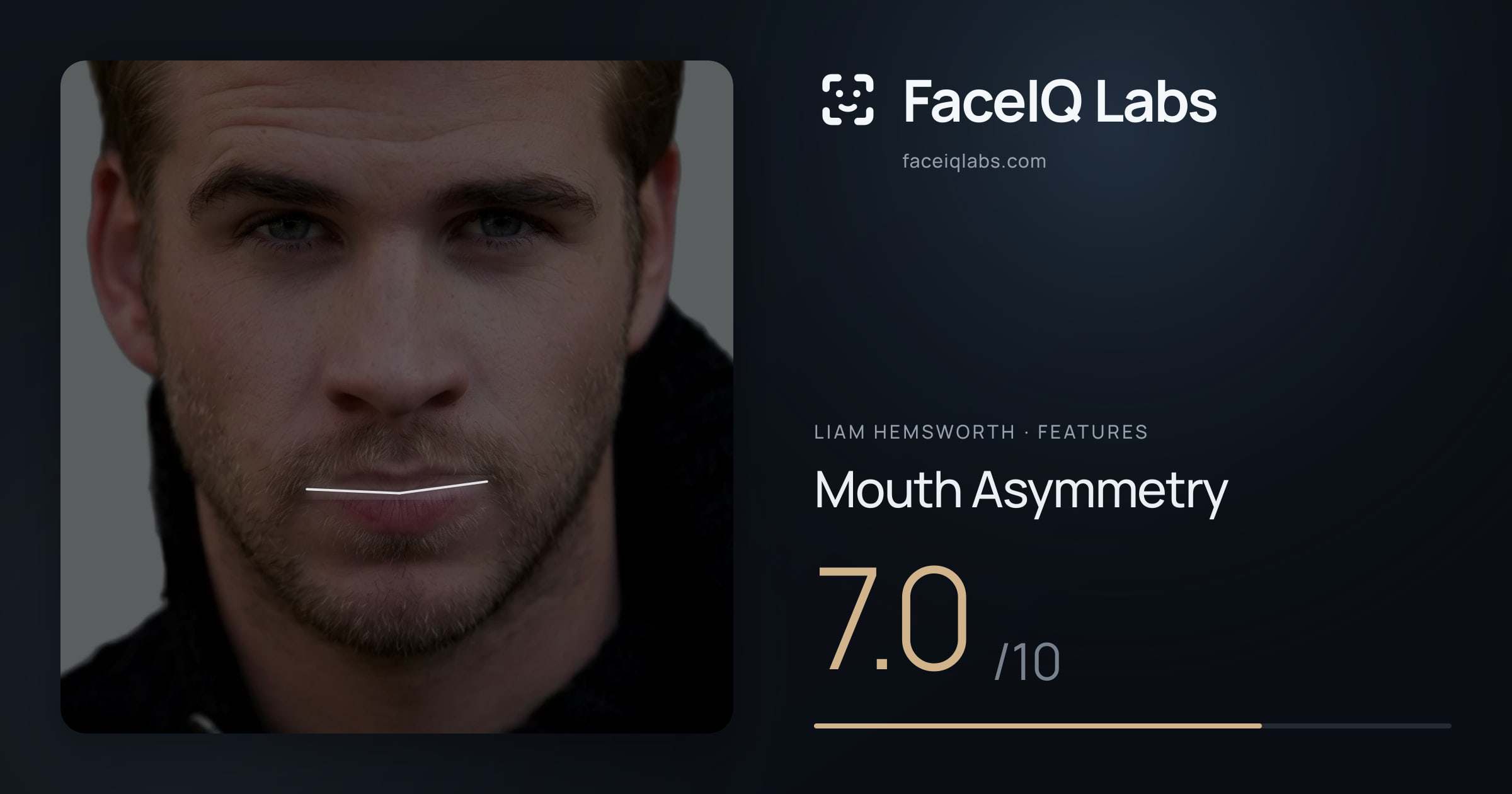 Liam Hemsworth Mouth Asymmetry: 7.0/10, drawn on the photo