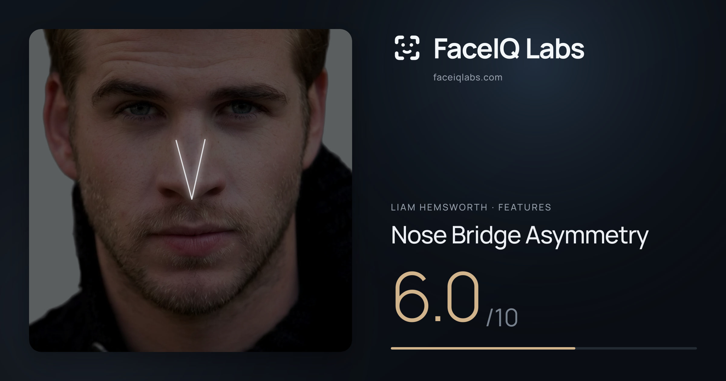 Liam Hemsworth Nose Bridge Asymmetry: 6.0/10, drawn on the photo
