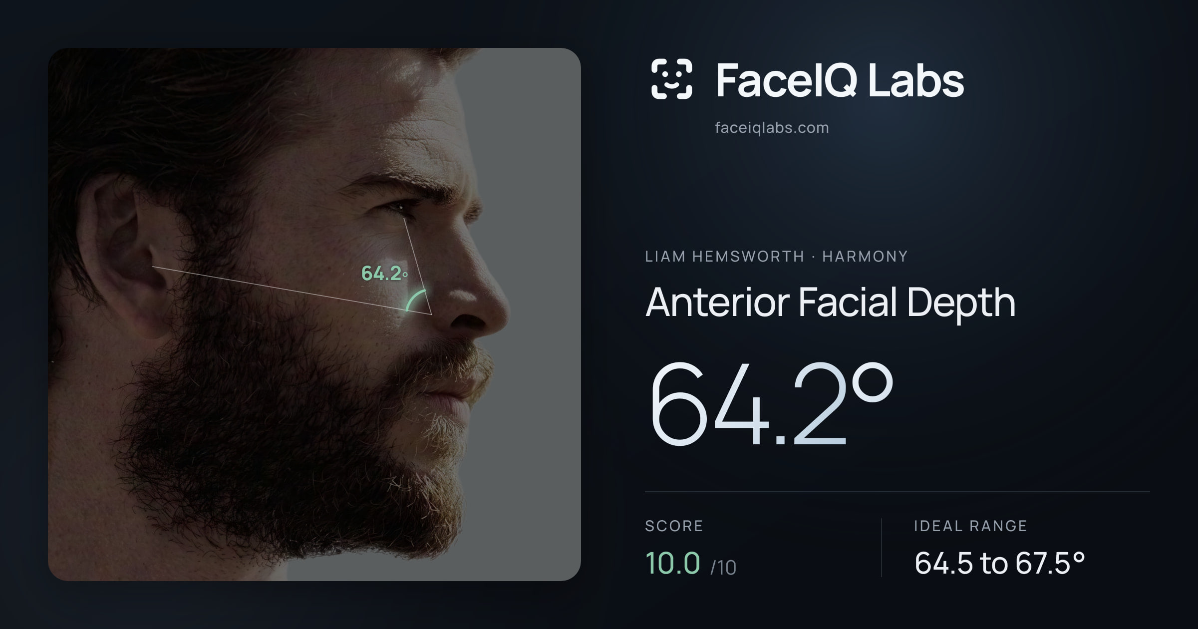 Liam Hemsworth Anterior Facial Depth: 64.2°, drawn on the photo