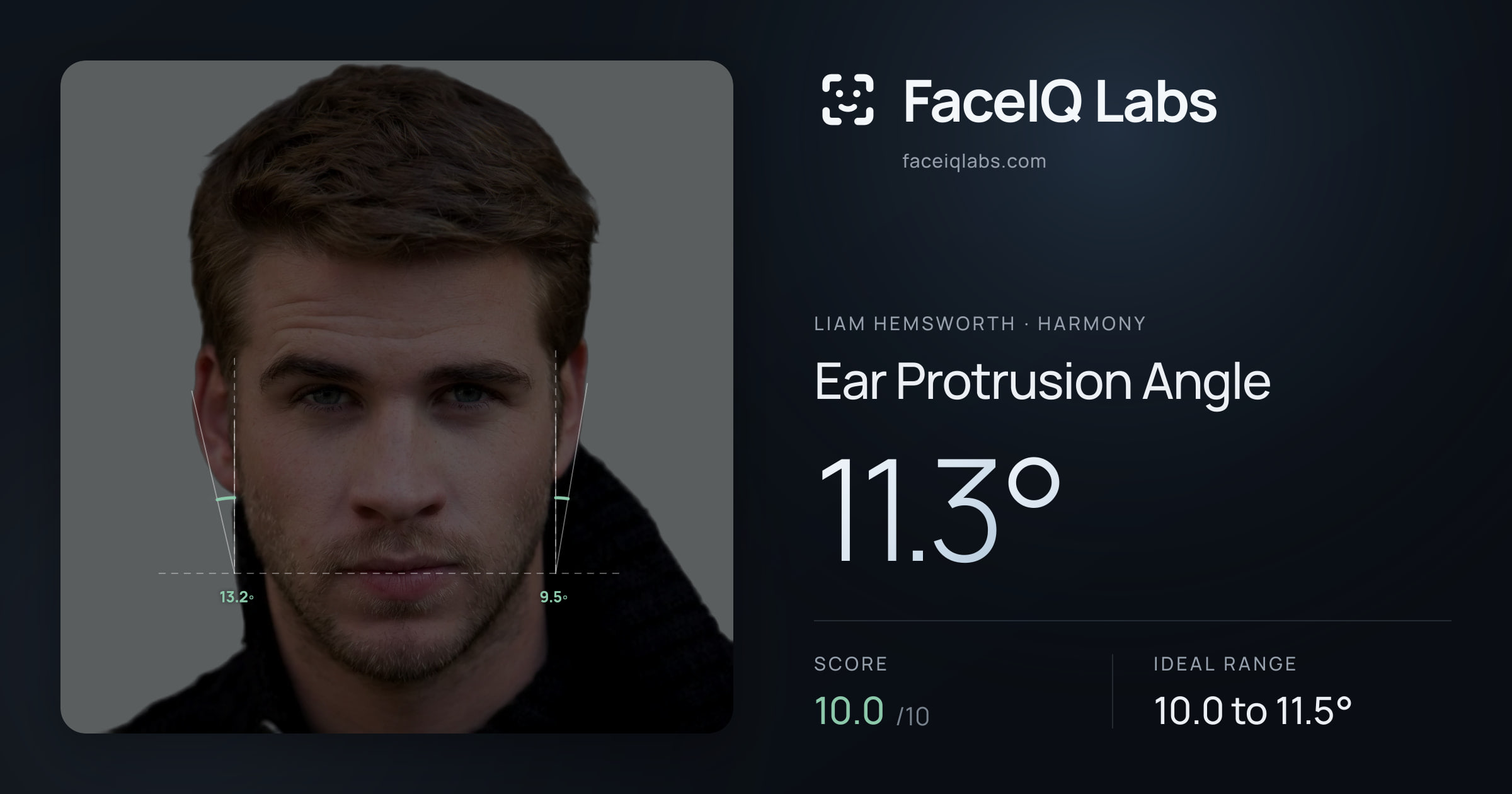 Liam Hemsworth Ear Protrusion Angle: 11.3°, drawn on the photo