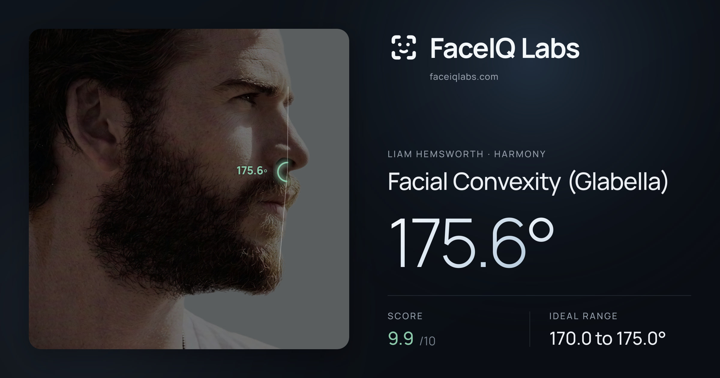 Liam Hemsworth Facial Convexity (Glabella): 175.6°, drawn on the photo