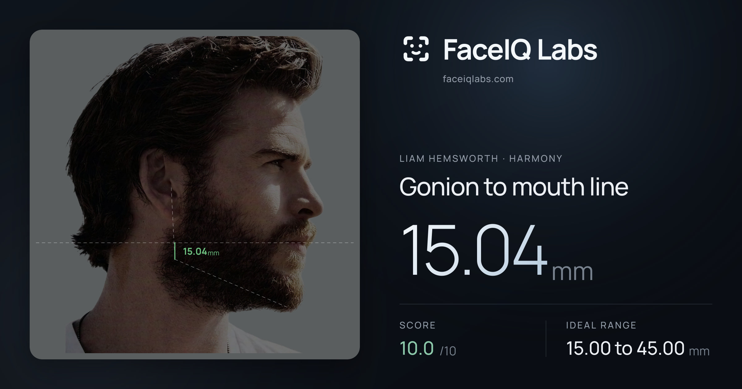 Liam Hemsworth Gonion to mouth line: 15.04mm, drawn on the photo