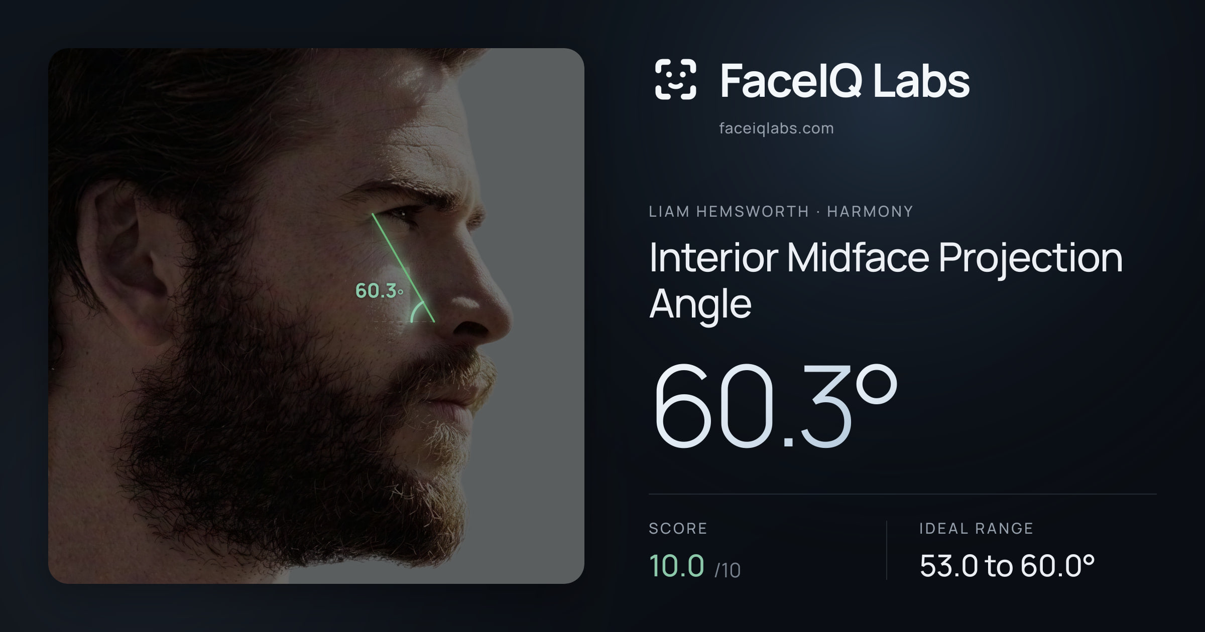 Liam Hemsworth Interior Midface Projection Angle: 60.3°, drawn on the photo
