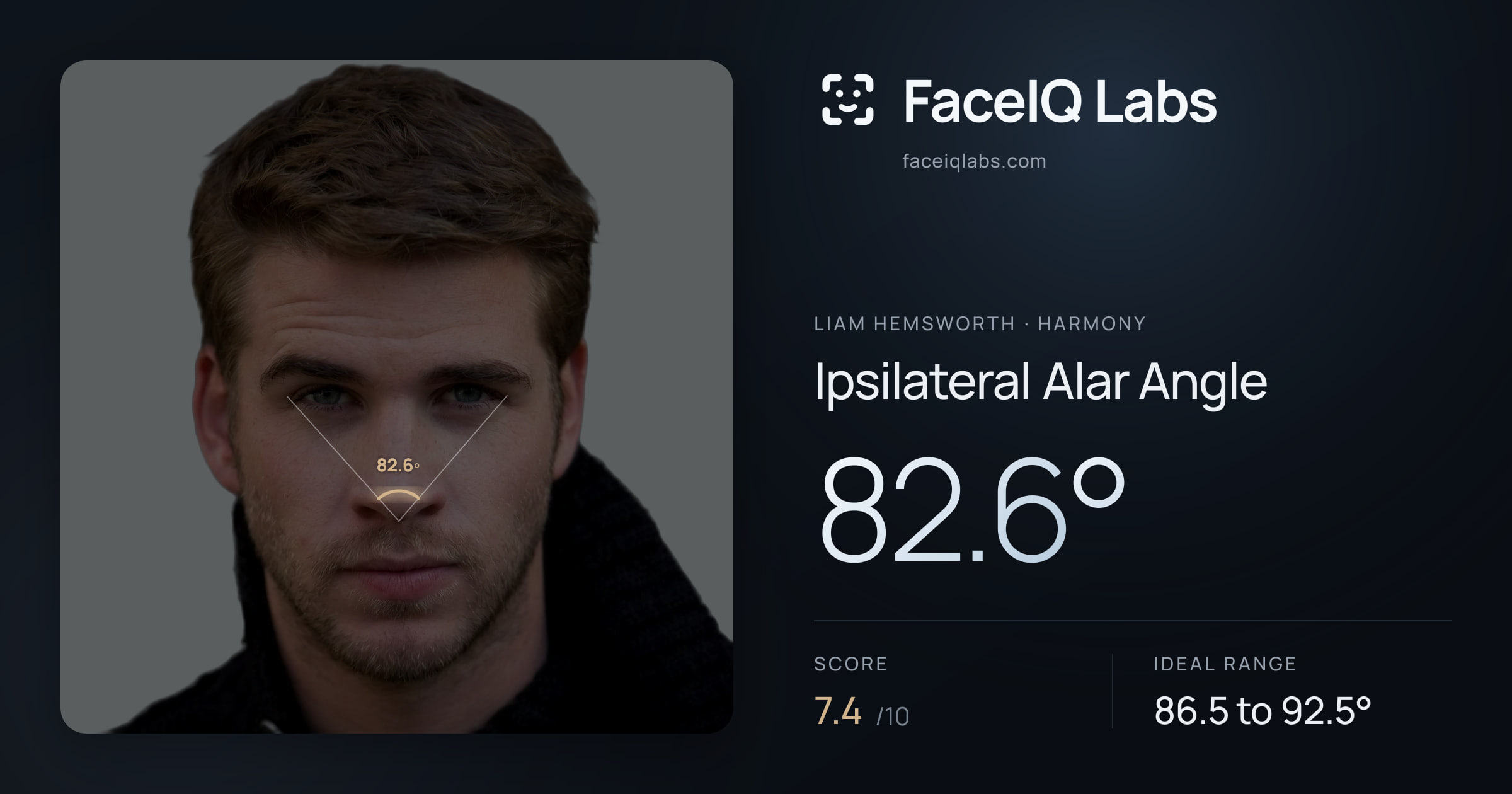 Liam Hemsworth Ipsilateral Alar Angle: 82.6°, drawn on the photo