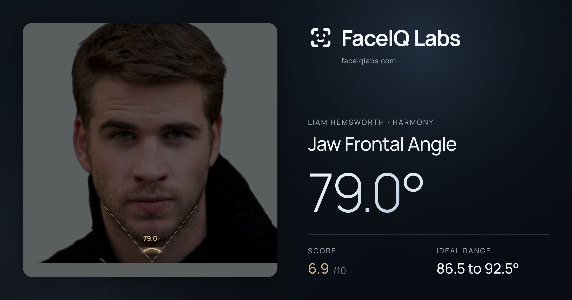 Liam Hemsworth Jaw Frontal Angle: 79.0°, drawn on the photo