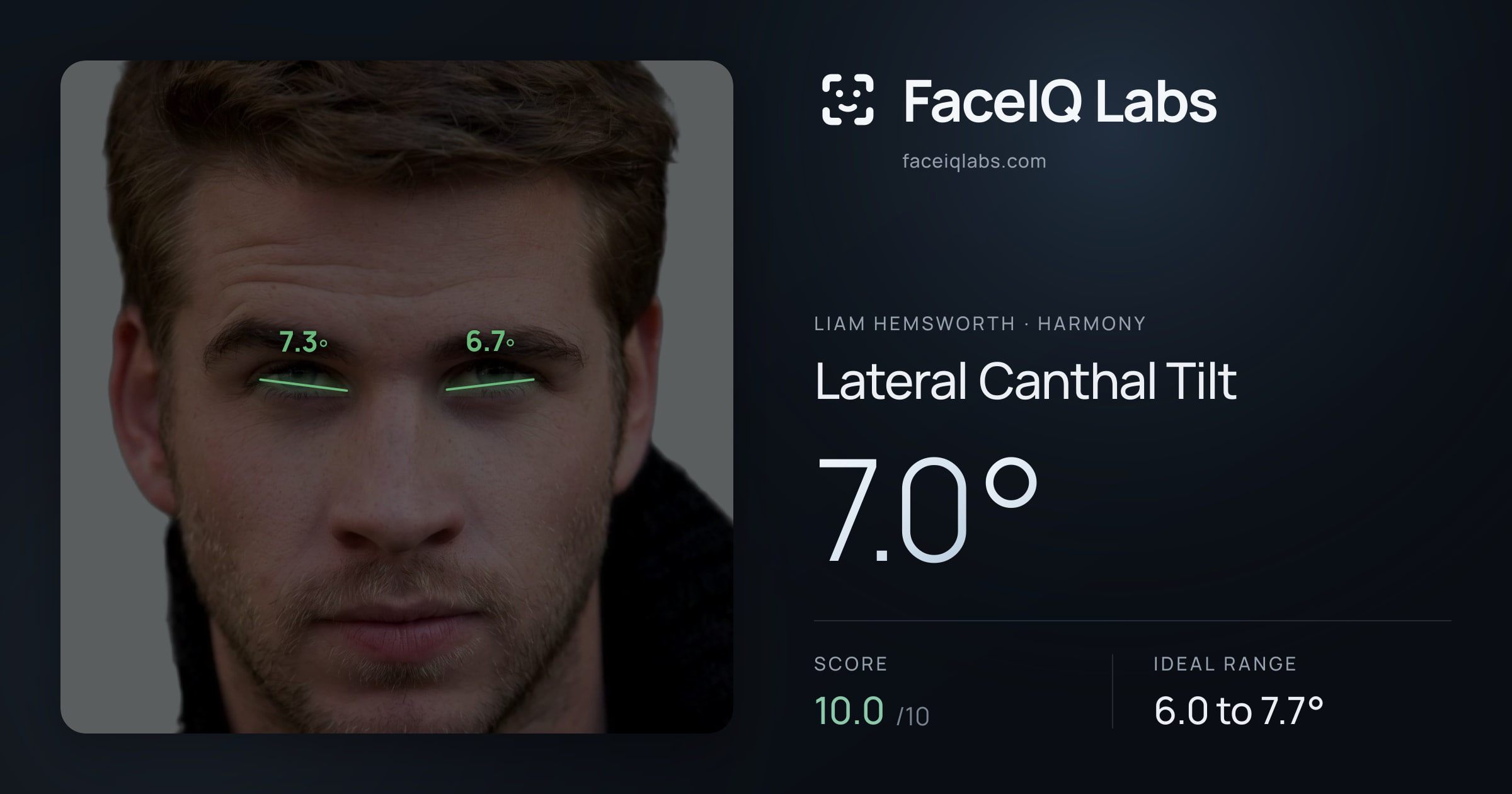 Liam Hemsworth Lateral Canthal Tilt: 7.0°, drawn on the photo