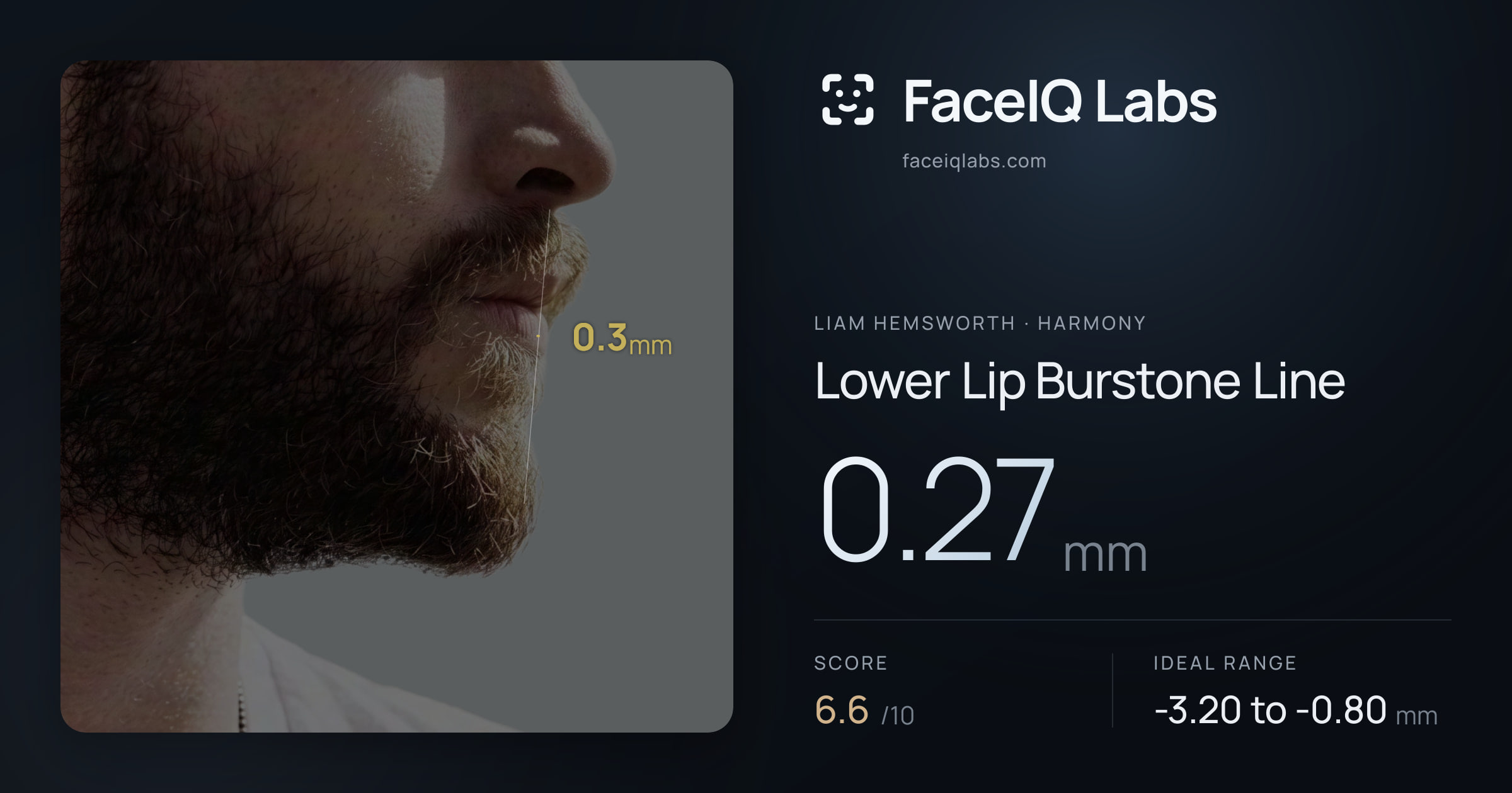 Liam Hemsworth Lower Lip Burstone Line: 0.27mm, drawn on the photo