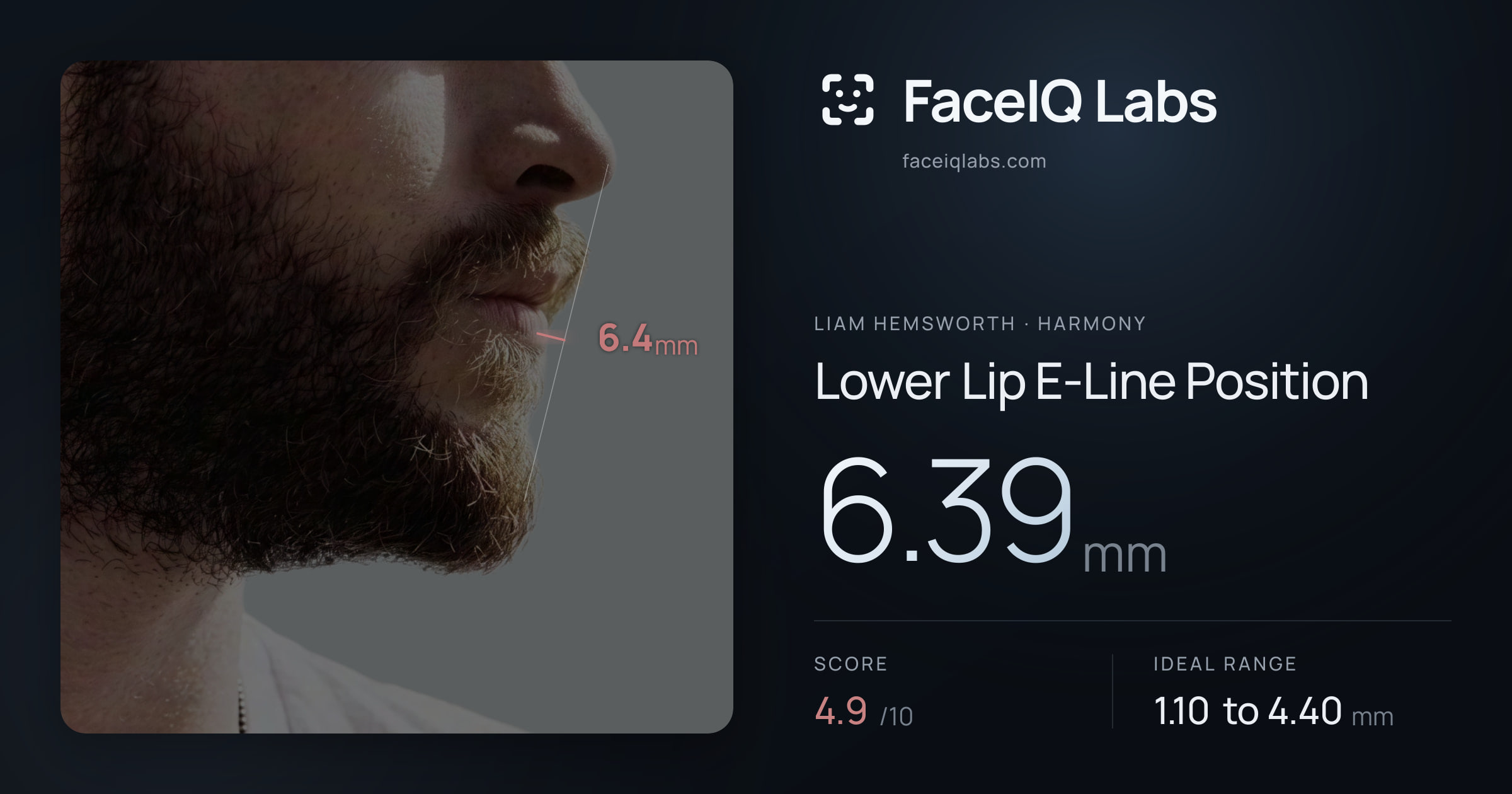 Liam Hemsworth Lower Lip E-Line Position: 6.39mm, drawn on the photo