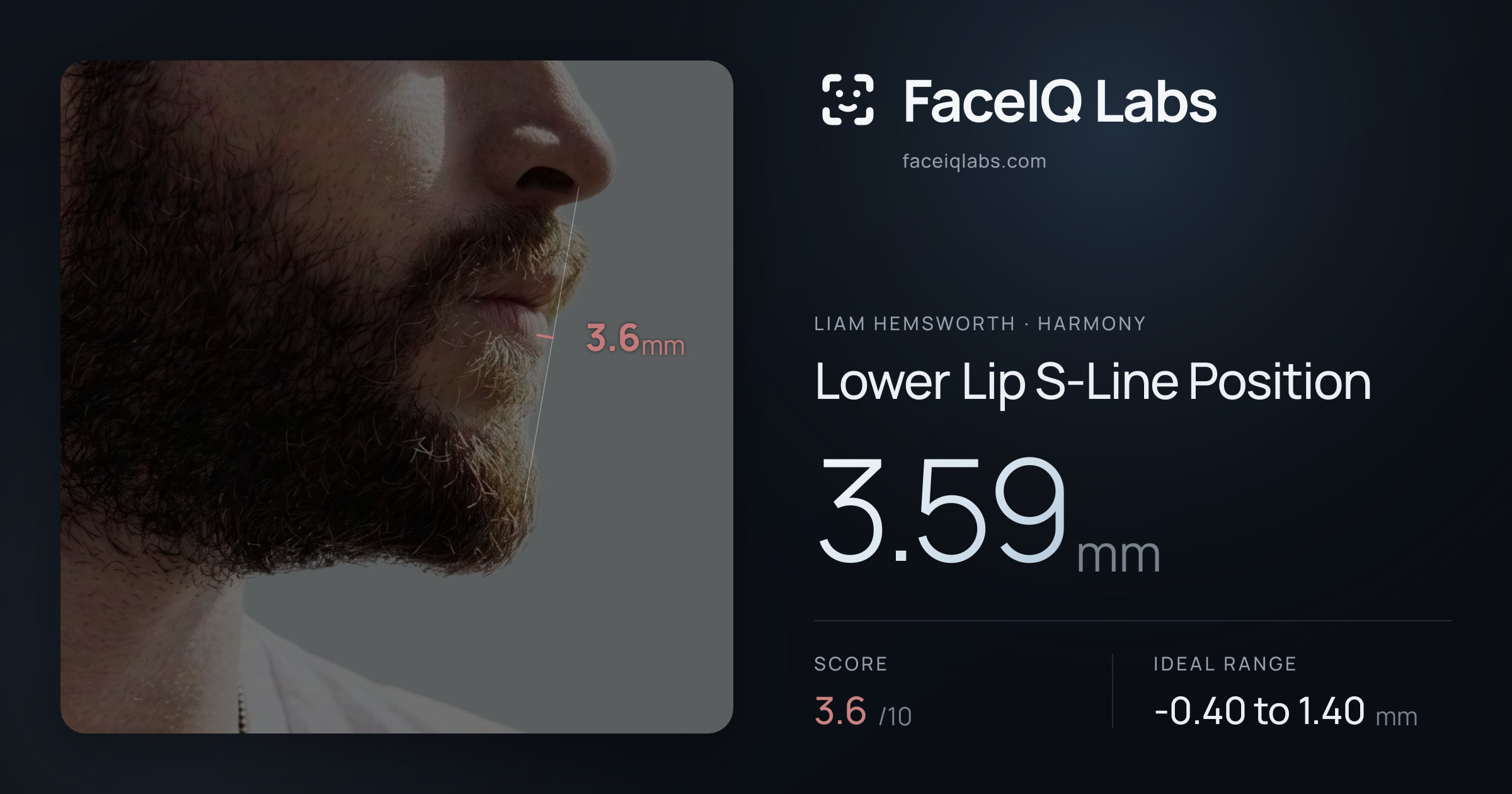 Liam Hemsworth Lower Lip S-Line Position: 3.59mm, drawn on the photo