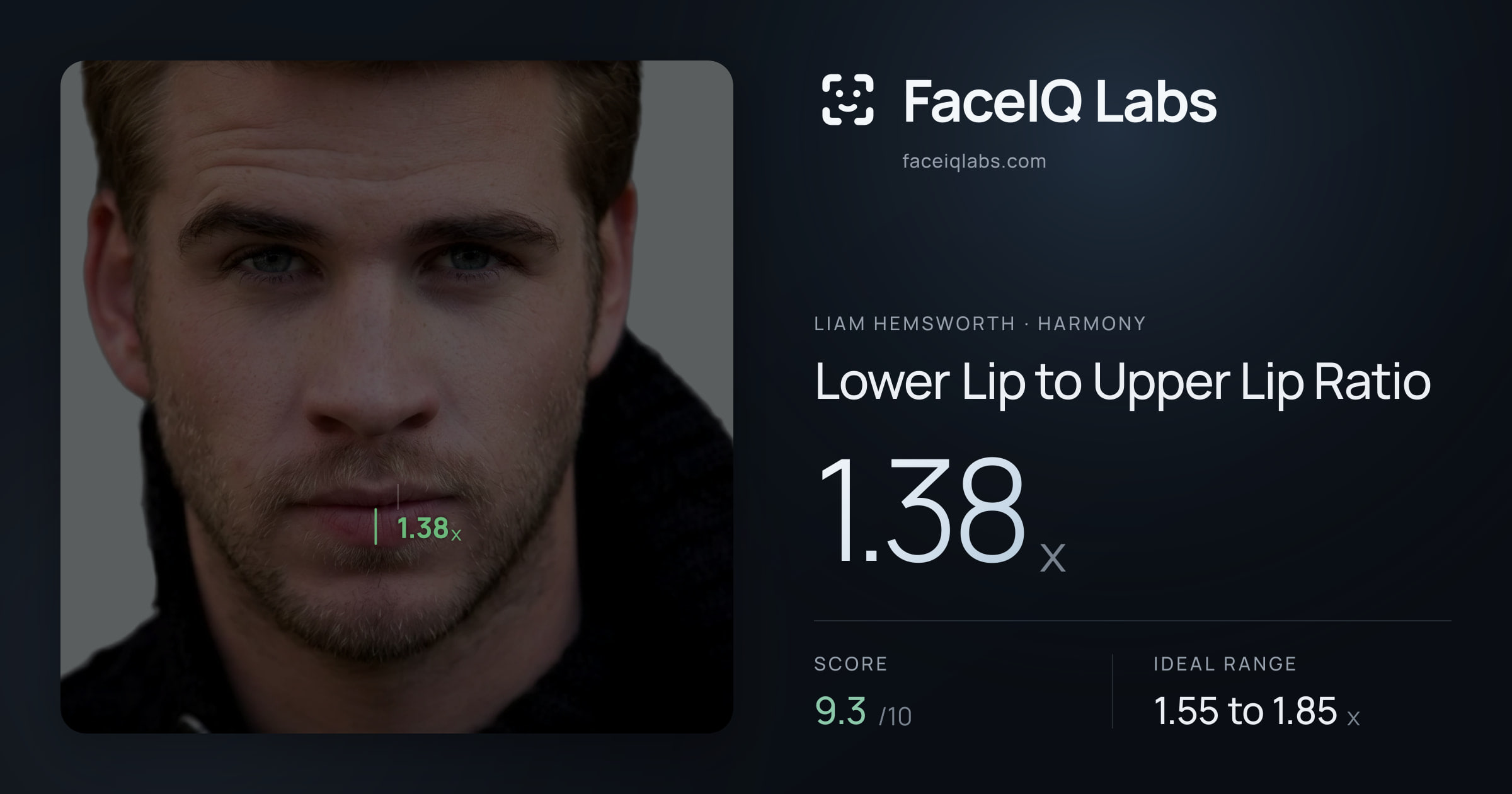 Liam Hemsworth Lower Lip to Upper Lip Ratio: 1.38x, drawn on the photo