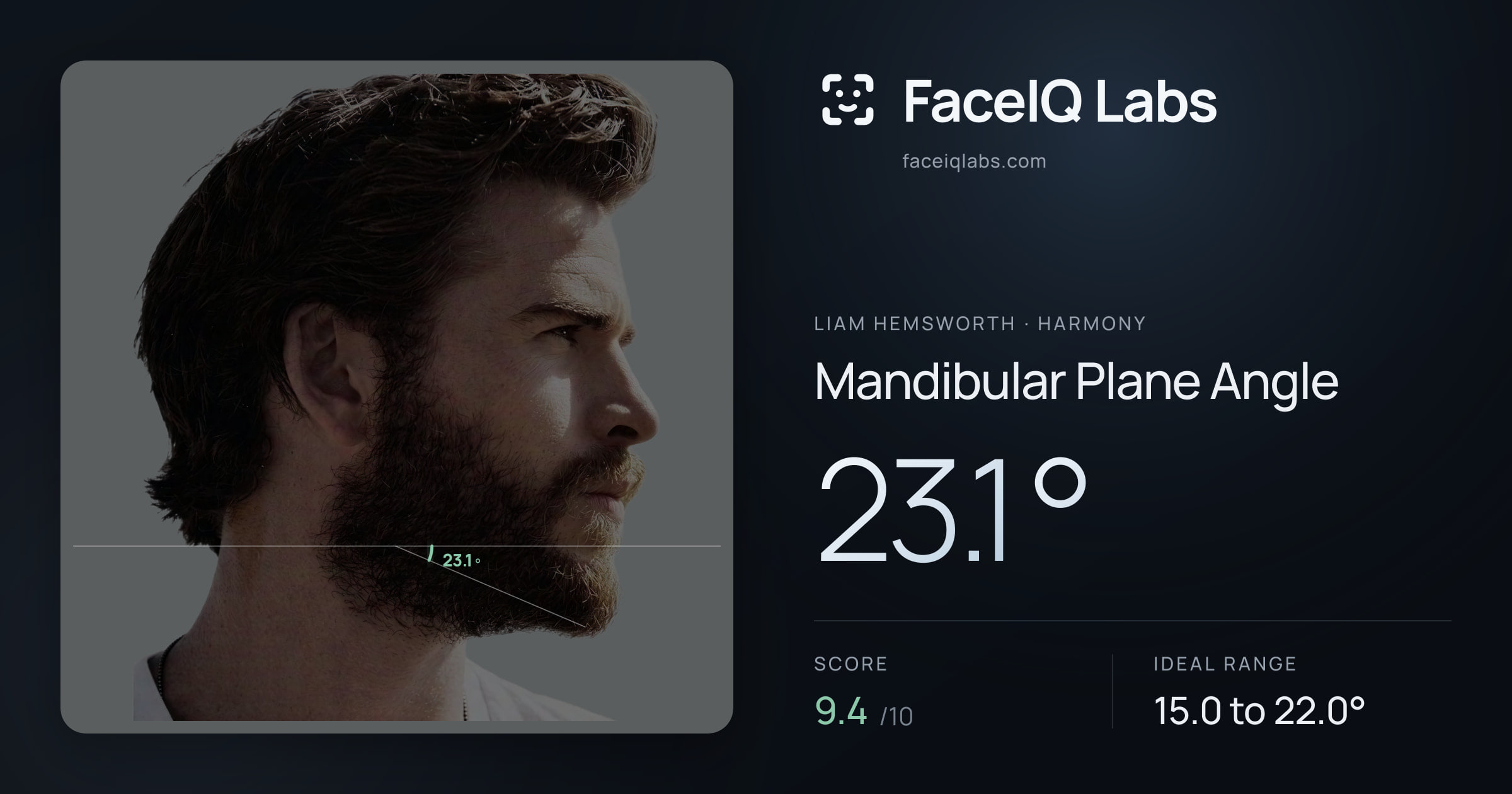 Liam Hemsworth Mandibular Plane Angle: 23.1°, drawn on the photo
