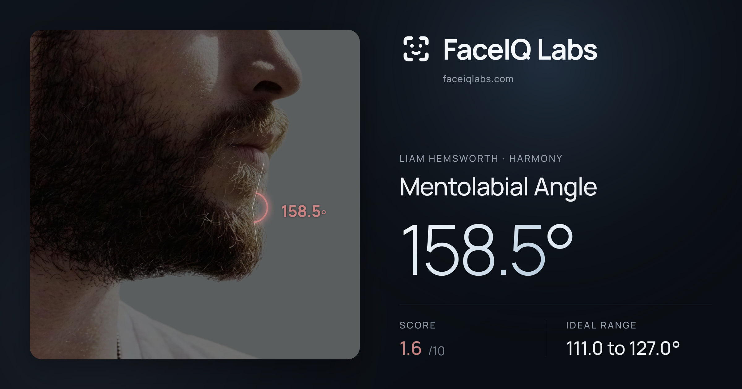 Liam Hemsworth Mentolabial Angle: 158.5°, drawn on the photo