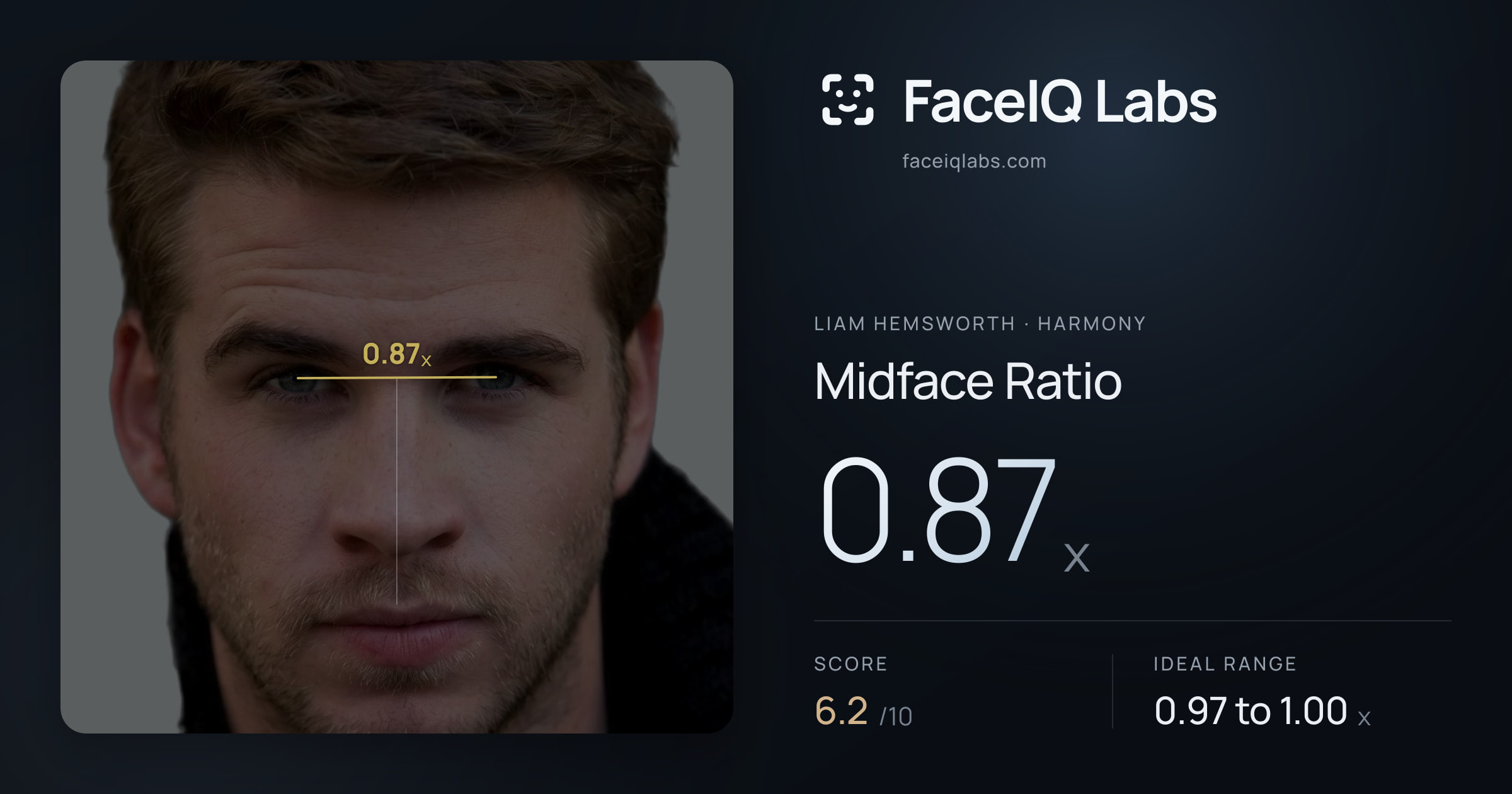 Liam Hemsworth Midface Ratio: 0.87x, drawn on the photo